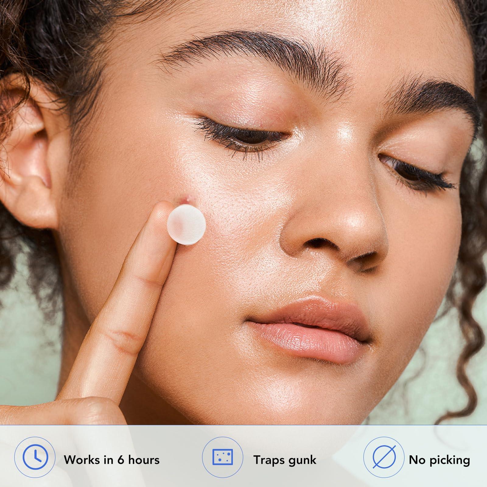 Qmakup Qmakup Pimple Patches for Face,Acne Patches for Face,Pimple Patch,Zit Patches,Hydrocolloid Blemish Patches for Covering Zits and Blemishes,with Salicylic Acid,Tea Tree oil & Calendula oil, 108 Counts