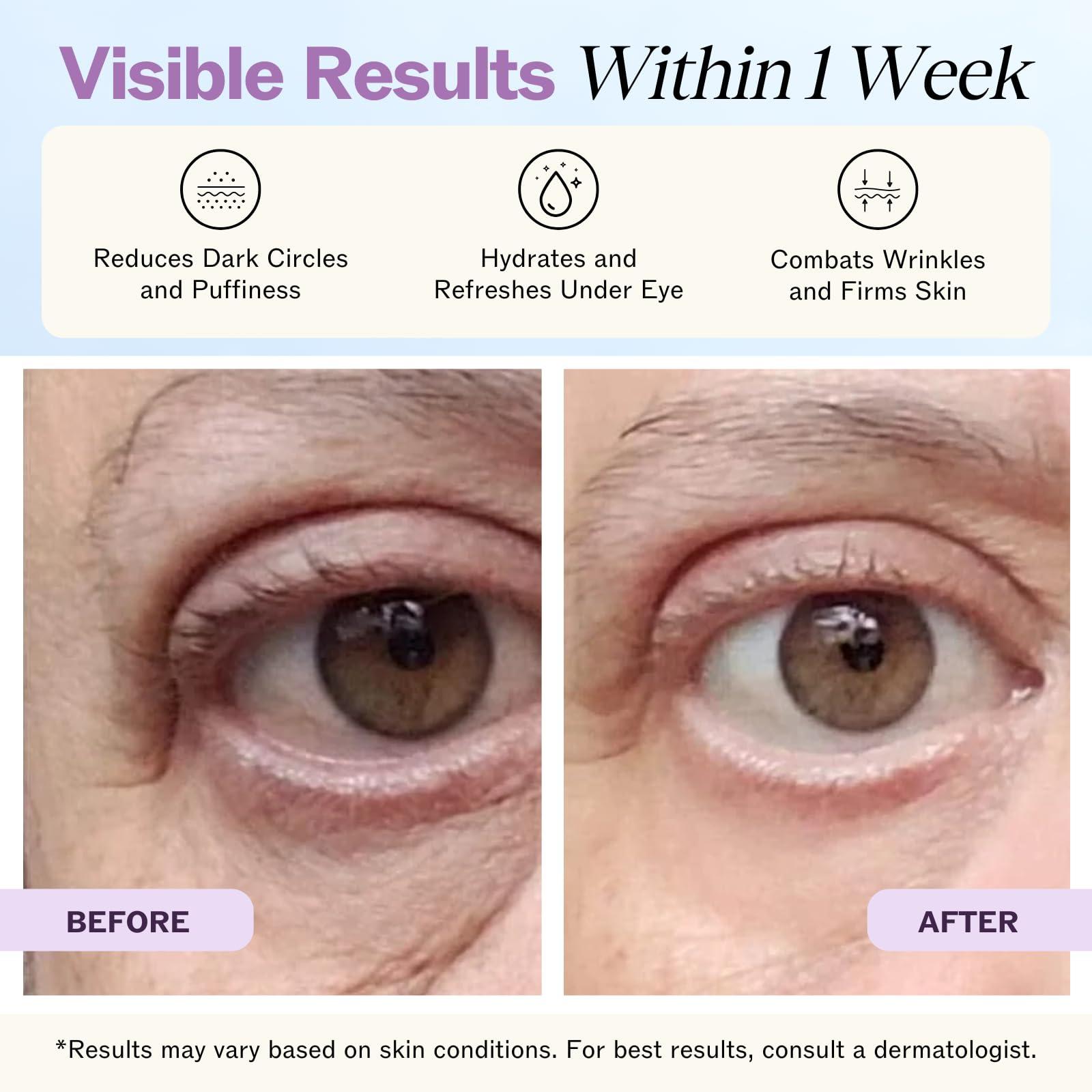 LilyAna Naturals LilyAna Naturals Eye Cream - Eye Cream for Dark Circles and Puffiness, Under Eye Cream, Anti Aging Eye Cream Reduce Fine Lines and Wrinkles (1.7 Ounce, Rosehip and Hibiscus (Tube))