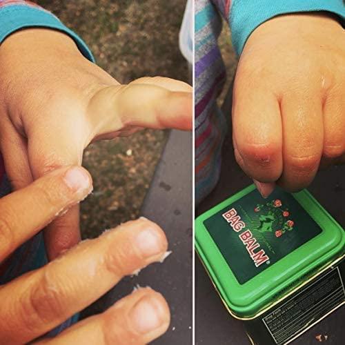 Bag Balm Bag Balm Skin Moisturizer - Full Body Hydrating Skin Care: Dry Hands, Lips, Face, Feet & More - Unscented, Cruelty & Paraben Free - Day & Night, Men & Women, Vermont\'s Original (4oz Tin, Made in USA)