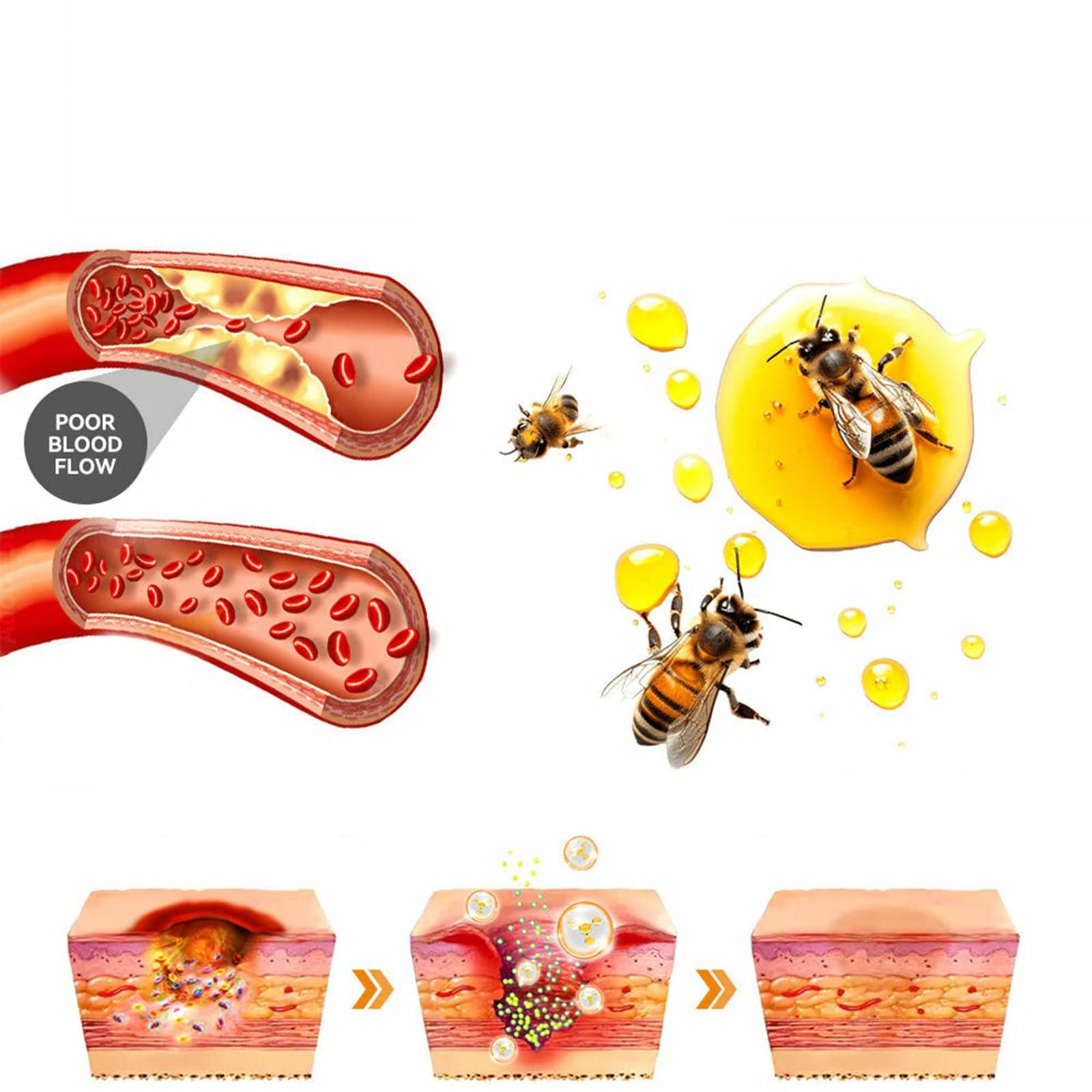 TLOPA TLOPA Bee Venom Treatment Cream, New Bee Venom Repair and Removing Cream,Hydrating Moisturizing Treatment cream for Men&Women,1Fl Oz (4)