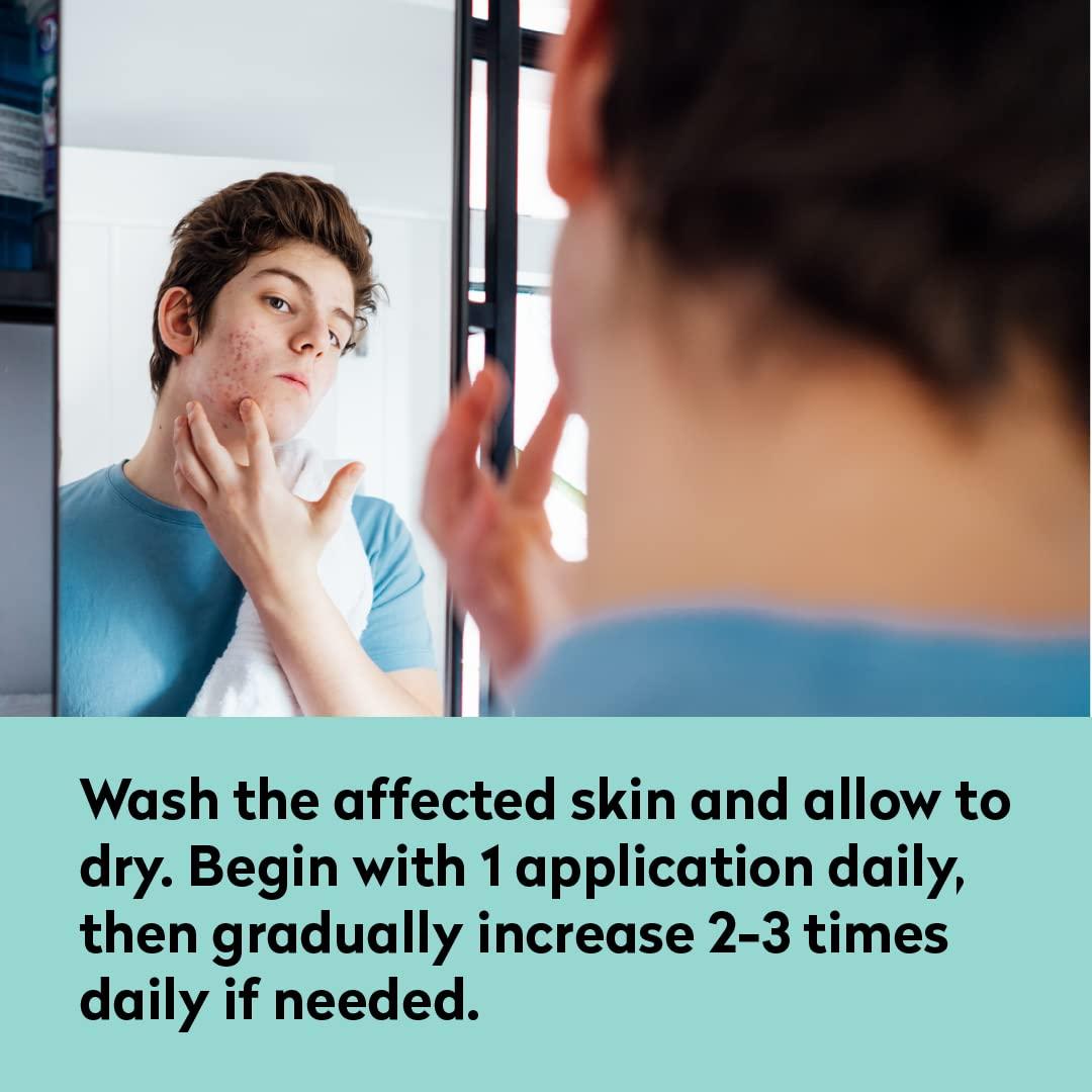 Dr. Blaine's All Acne Treatment - Face and Body - Spot and Full Coverage - Gel Formula - 9 Skin Boosters