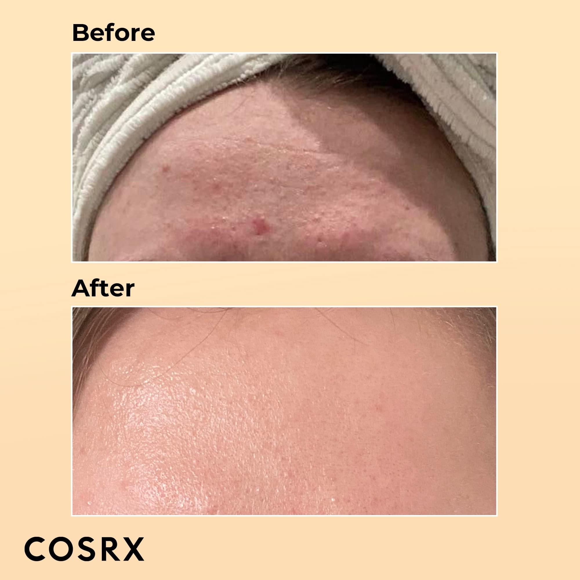 COSRX COSRX Skin Cycling Routine - Snail Mucin 96% Essence + Retinol 0.1 Cream, Recovery Set for Face and Neck, Fine Lines Spot Treatment, Repair Cream for Face