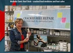 Luxuriant Luxuriant Cracked Heel Repair The ORIGINAL Twin Pack 2.5oz Dry Cracked Chapped Heels Feet Elbows Knees Skin