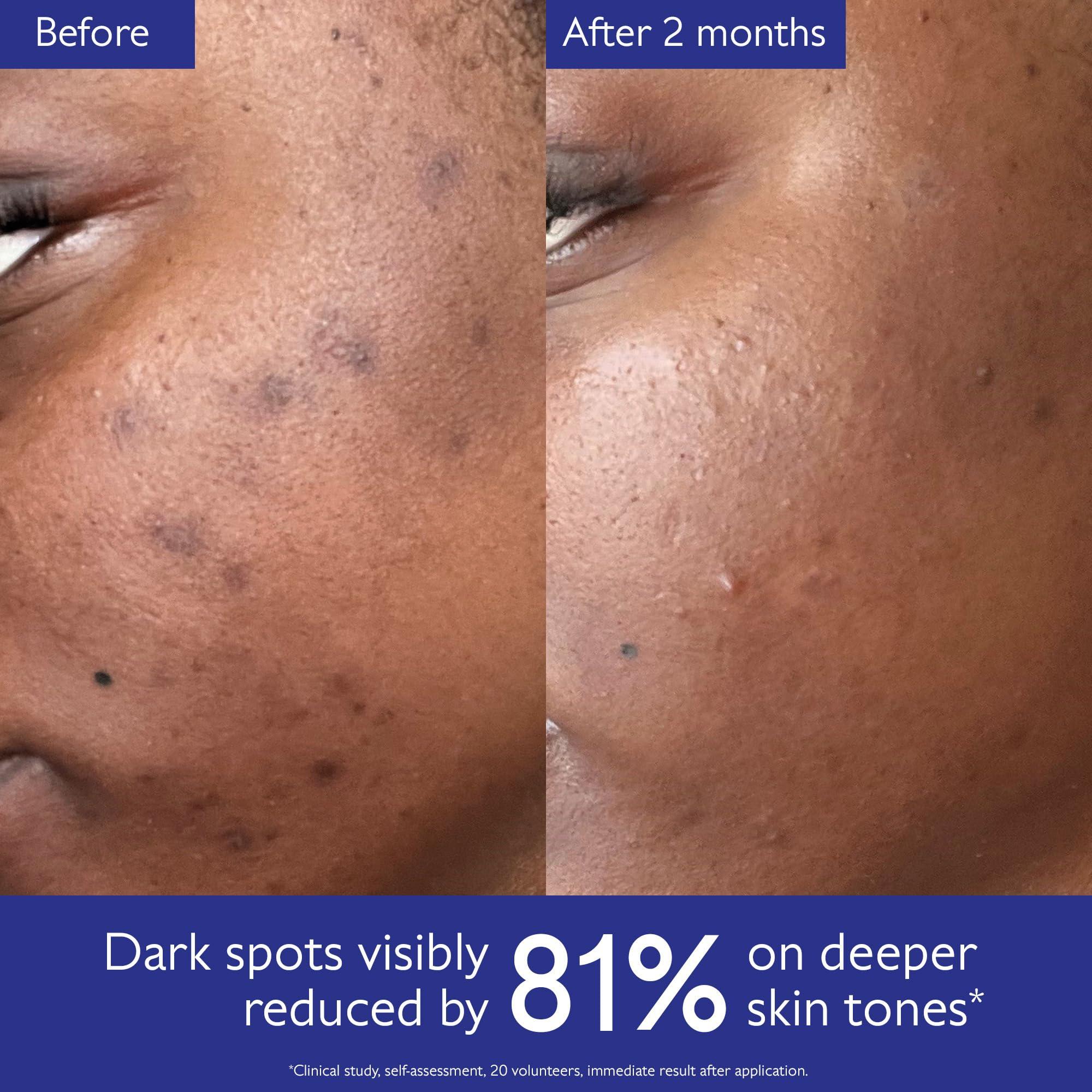 Caudalie Caudalie Vinoperfect Brightening Dark Spot Serum Vitamin C Alternative - Jumbo Size 62x More Effective than Vitamin C with Viniferine for a Visibly Brighter Even Complexion