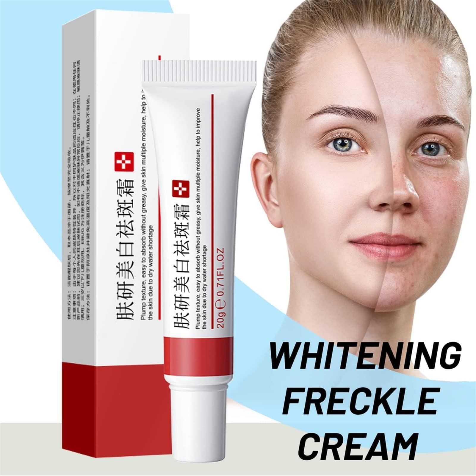 fupah 2 Pcs Freckle Cream, Acne Scar Removal Treatment Cream, Pigmentation Removal Cream for Face, Moisturizing Removes Facial Melasma Dark Spots Wrinkles Blemishes (freckle cream)