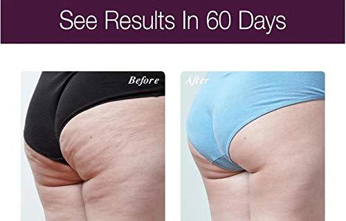 Osmotics Cosmeceuticals Osmotics Anti-Aging Body Lift, Age-Defying Body Serum, Firms The Bust, Belly & Behind For a Visible Lift, Dermatologist Recommended