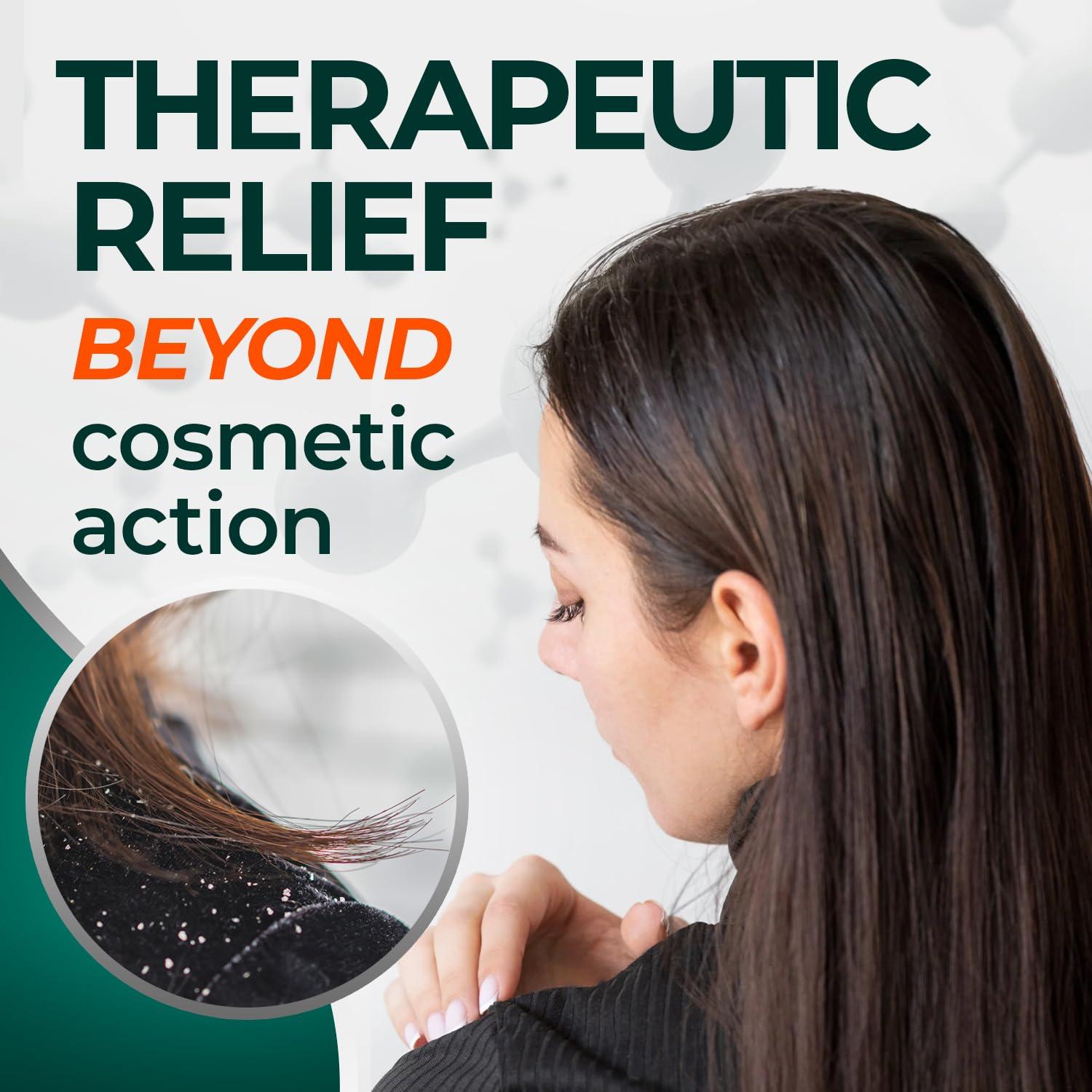 Medicasp Medicasp Coal Tar Gel Dandruff Shampoo to Treat Seborrheic Dermatitis Psoriasis, 6 Ounce (Pack of 1)