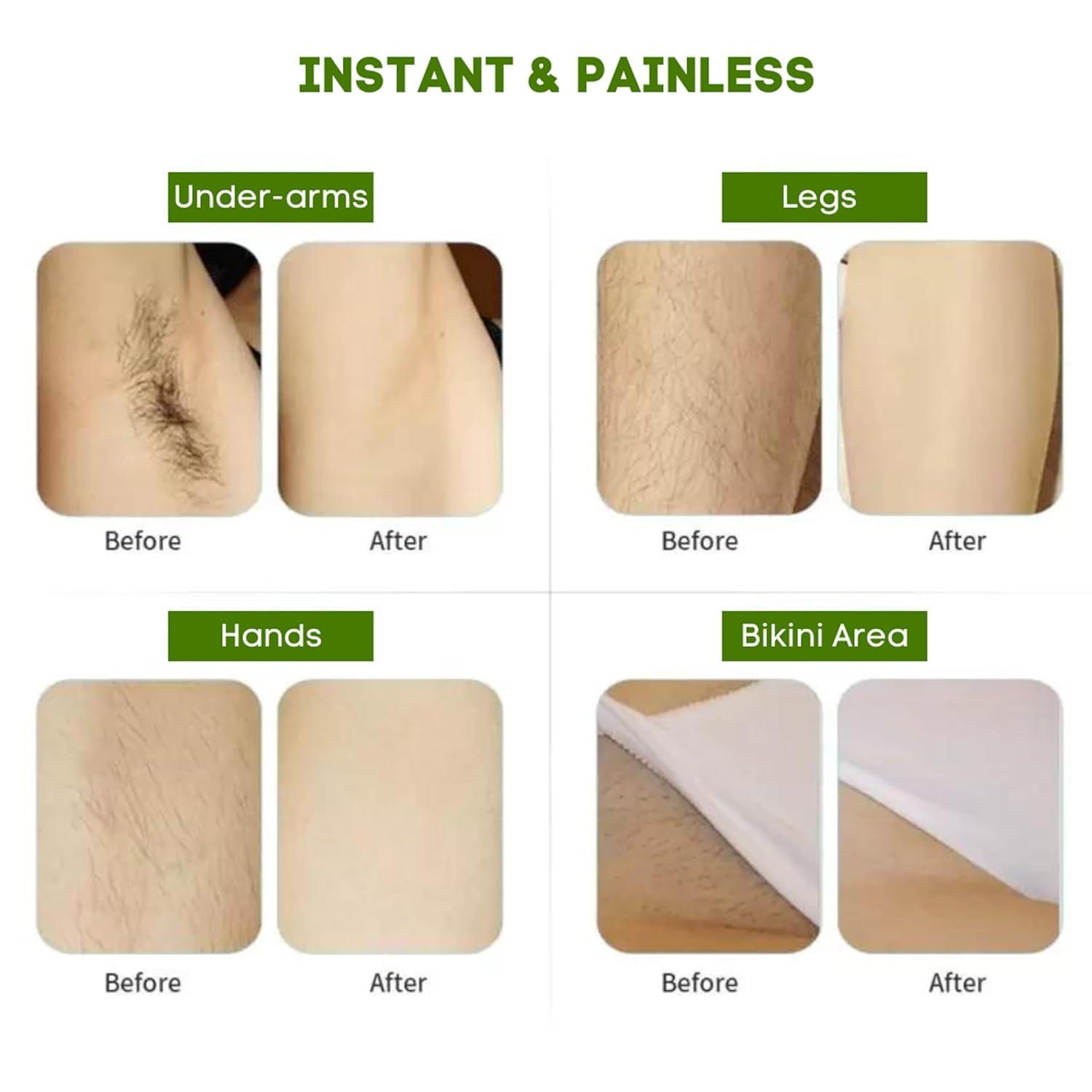 Generic DD Women Herbal Hair Removal Wax Powder (100G) - Painless & Odourless For Smooth Skin