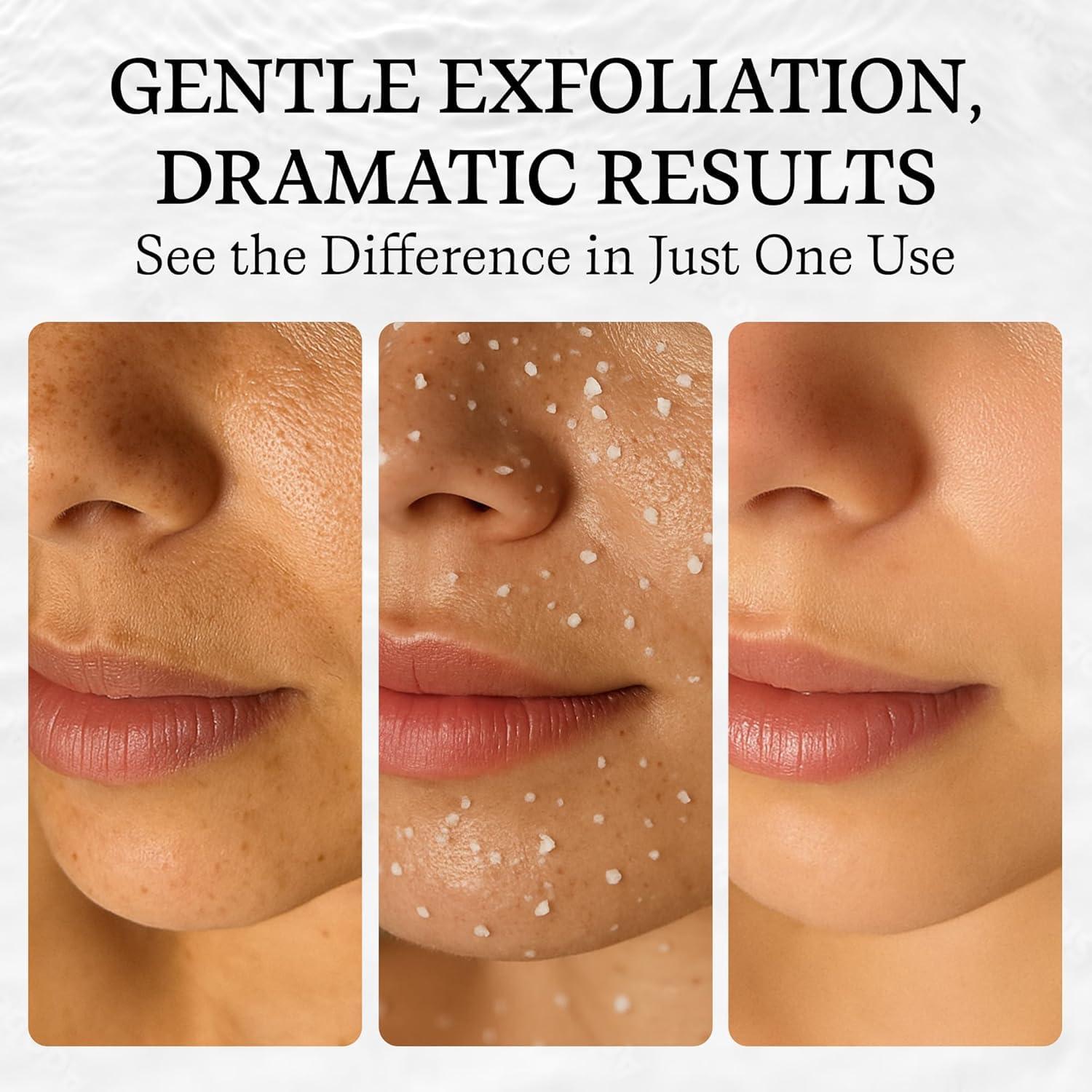 Vivo Per Lei Vivo Per Lei Facial Peeling Gel - Contains Dead Sea Minerals and Nut Shell Powder - Gentle Face Exfoliator Scrub and Blackhead Remover - Pack of 3