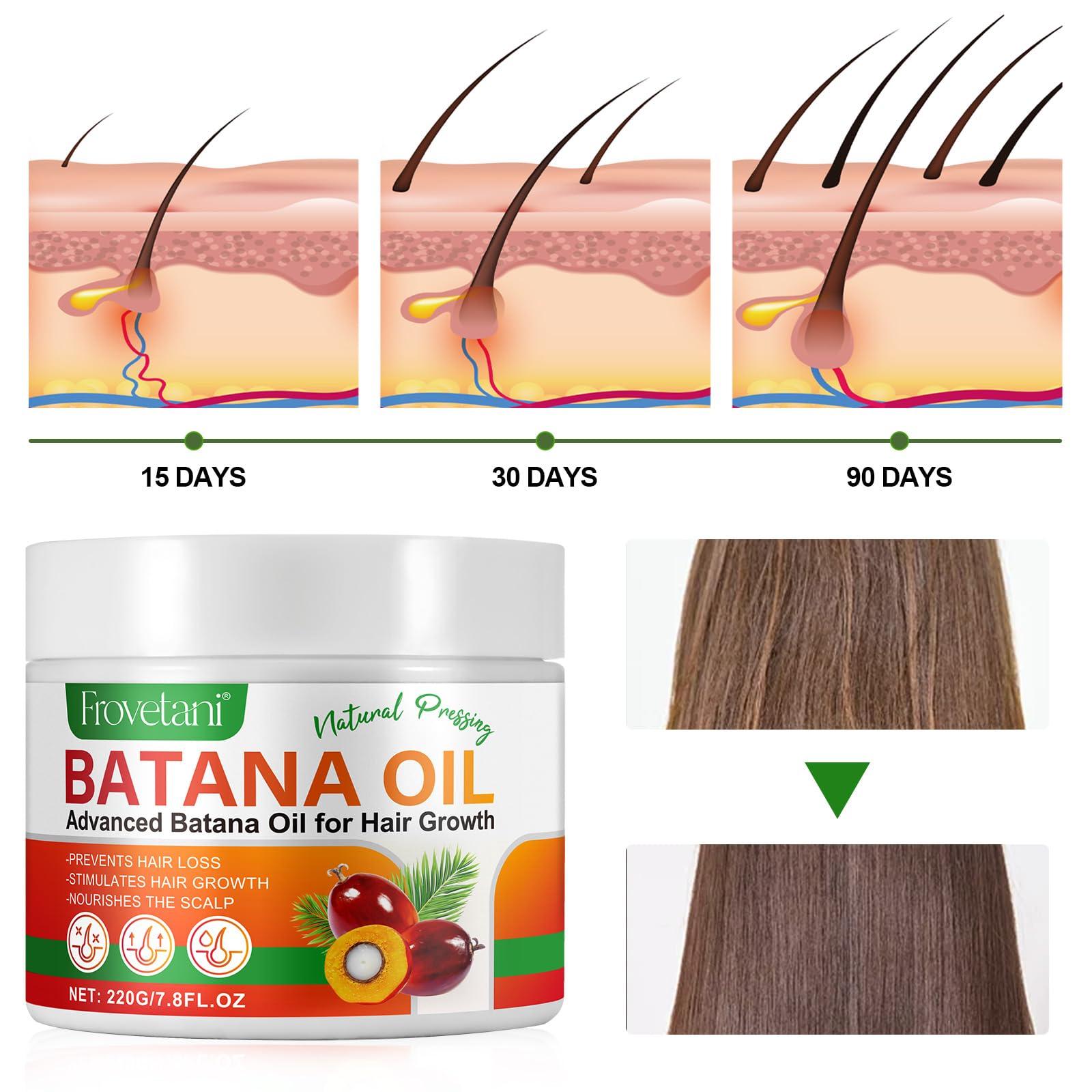 Frovetani Frovetani Batana Oil from Honduras for Hair Growth, 100% Organic Raw , Promotes Hair Thickness, Healthier & Strengthening, Prevents Hair Loss 7.8FL.OZ