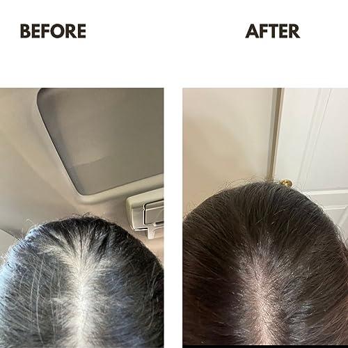 ZAIN1.618 Natural Hair growth Shampoo With Snail Mucin, Rosemary, Biotin, Niacinamide, Castor oil and Caffeine.(Mimosa, 8.45 oz) pH Level 5.2