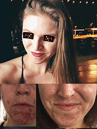 Herbal Power Peel Herbal Power Peel- Chemical & Acid Free Green Herbal Deep Sea Peel-Professional or Home Use