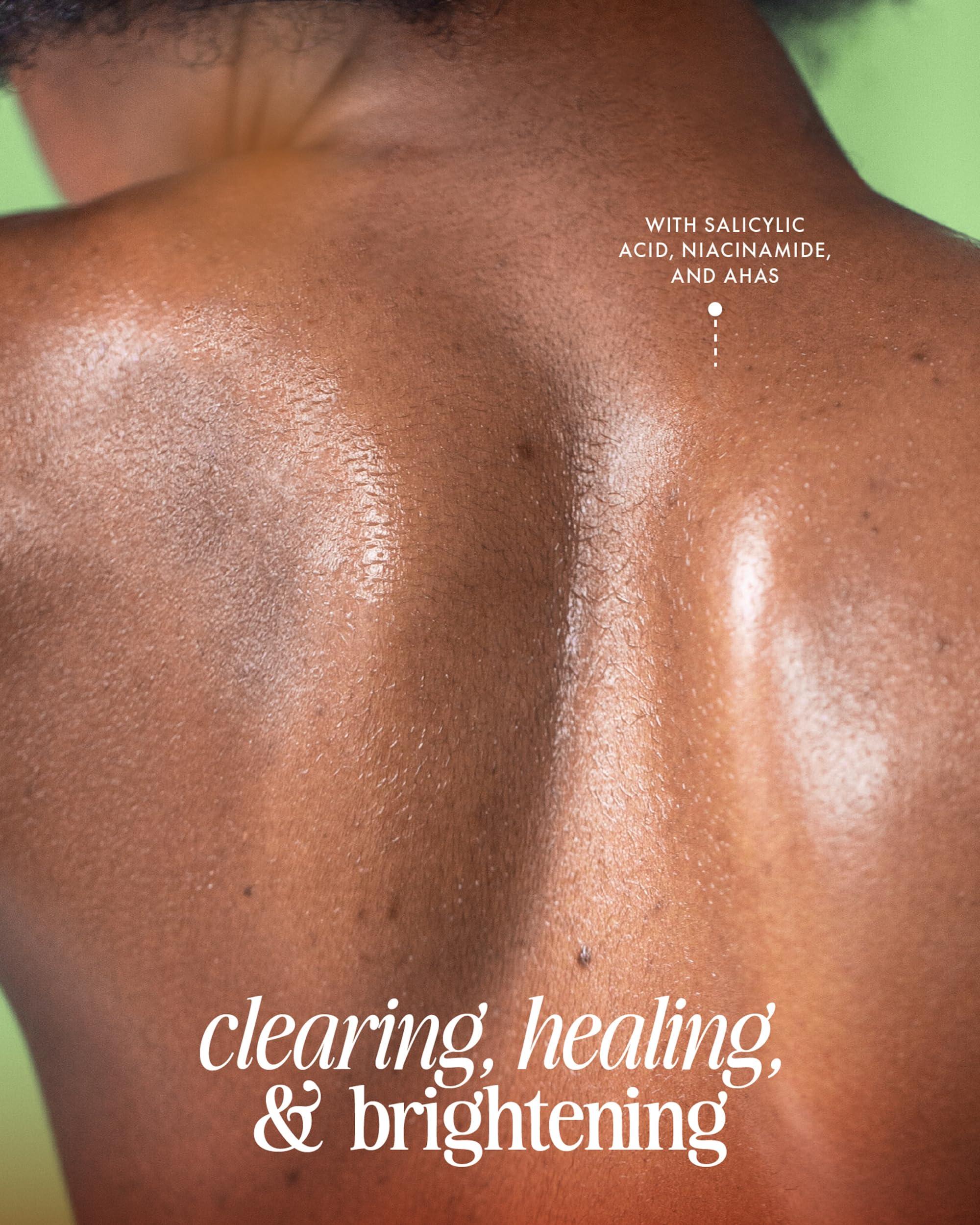 Truly Truly Beauty Cherry Jelly Body Acne Wash with Soothing Cherry Niacinamide, Hydrating Allantoin, & Mandelic Acid - Award Winning Back Acne Treatment Body Wash Cleanser & Dark Spot Remover