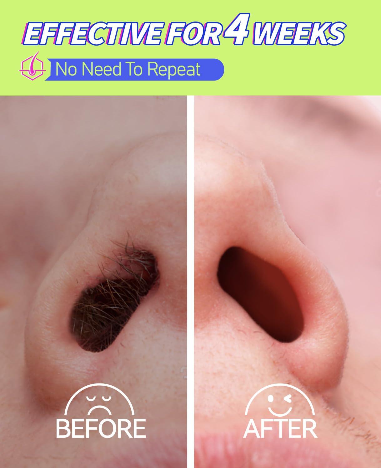 unimiko Unimiko Nose Hair Wax Kit, Nose Wax Kit Men with 200g Nose Wax, 40 Applicators for 30-40 Uses. Easy, Quick & Painless Instant Nose Waxing Kit for Men