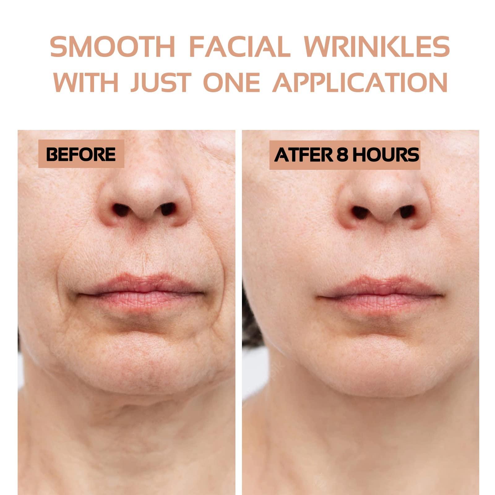 ENROSLU Face Wrinkle Patches 256Pcs - Clear Reusable Pads for Overnight Anti-Wrinkle Treatment - Fine Line Remover Strips to Smooth Eye, Mouth and Forehead - Train Facial Muscles for Smoother Skin