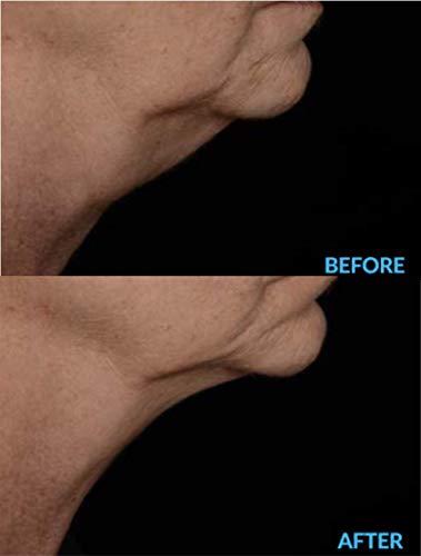 AminoGenesis AminoGenesis N.E.C.K Control: Neck Lifting, Firming And Retracting Cream