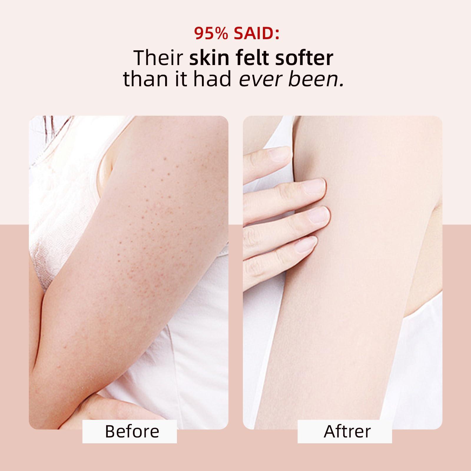 YAFUSIPE KP Bump Eraser Body Scrub with 10% AHA BHA Ingrown Hair Keratosis Pilaris Razor Bump Treatment Exfoliating Body Scrub Exfoliator Exfoliant Face Scrub for Strawberry Leg Pre-shaven Blackhead 4.23OZ