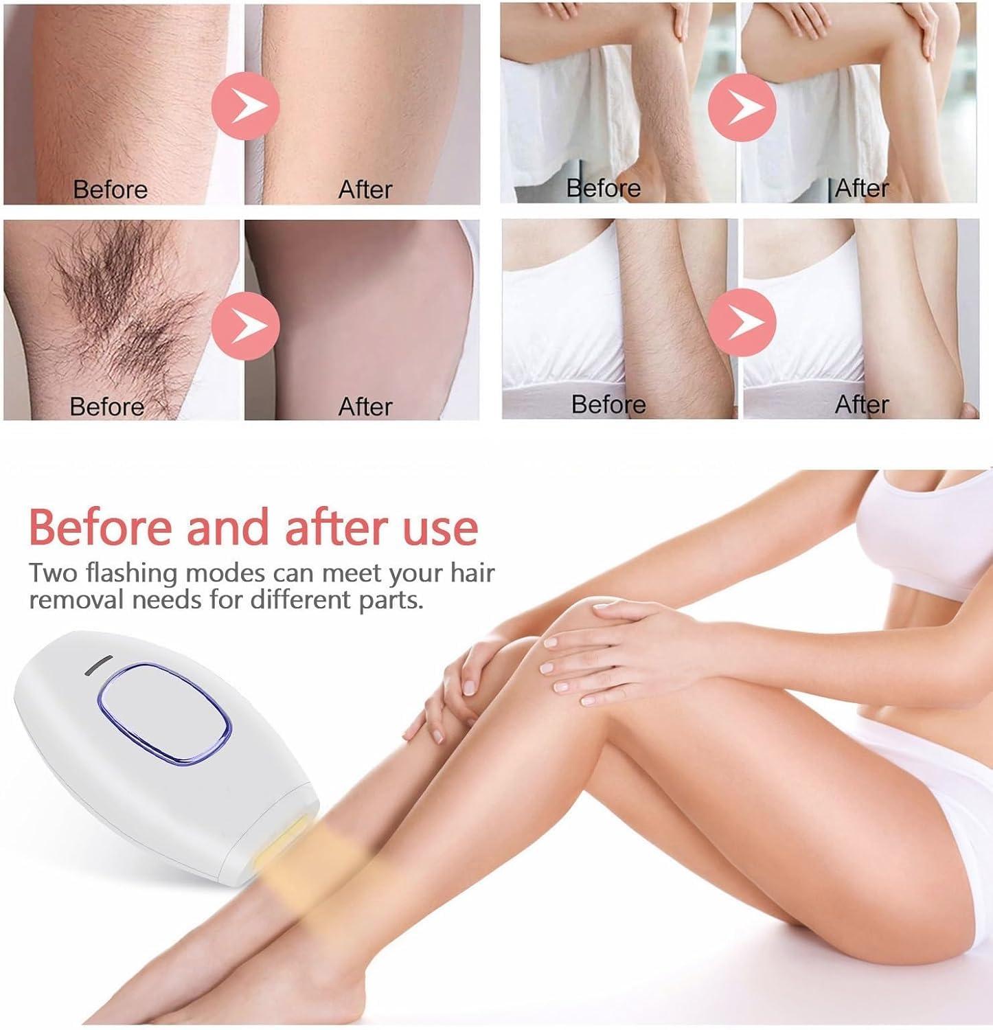 Gransumr Home Use Beauty Device IPL Laser Hair Removal for Women and Men,999999 Flashes at-Home Laser Hair Removal Device