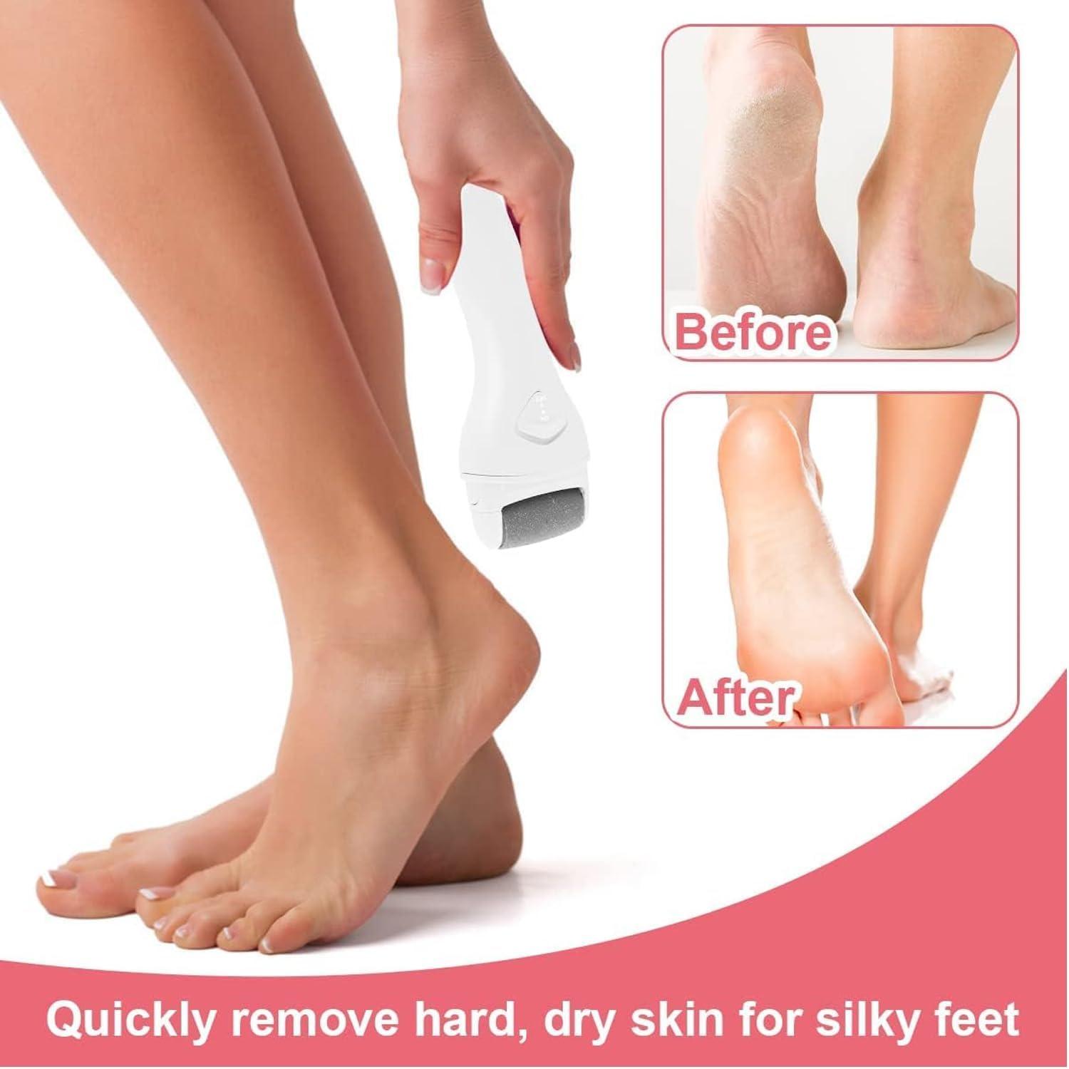 PeakTrend PeakTrend Electric Foot File Grinder Dead Dry Skin Callus Remover Rechargeable Feet Pedicure Tool Foot Care Tools for Hard Cracked Clean with 2 Grinding Heads