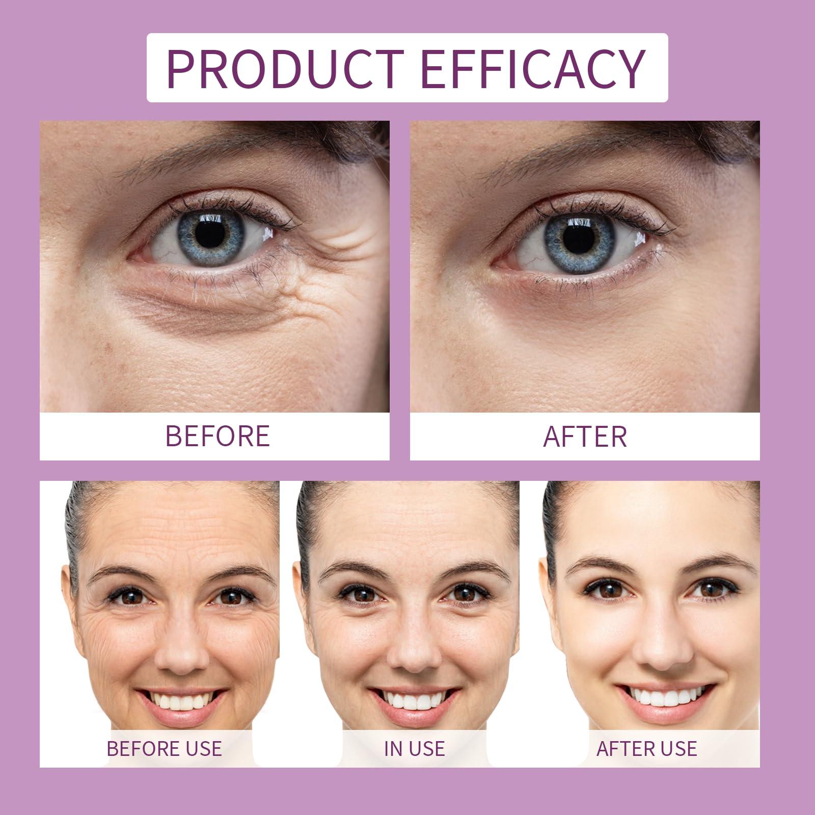 KIUORET Bakuchiol Retinol Serum for Anti-Aging, Bakuchiol Retinol Rejuvenation Serum Reduces Acne, Wrinkles and Fine Lines, Retinol Serum for Moisturizing & Smoothing for All Skins, 30 ml