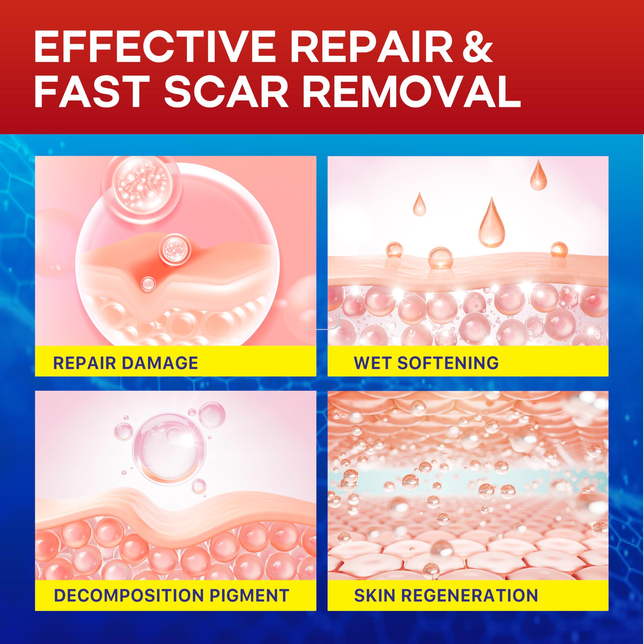 Umaeost 1.6\"x 120\" Medical Silicone Scar tape for Scars: Medical Grade Scar Sheets Reduces the Appearance of Scars from surgical Acne Stitches Burns More