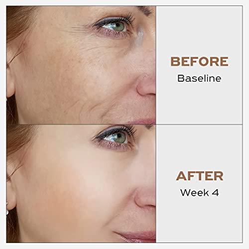 IGAME IGAME Niacinamide Cream-P010 | Improves Skin Tone | Anti Aging Face Moisturizer | 1.7 Fl. Oz