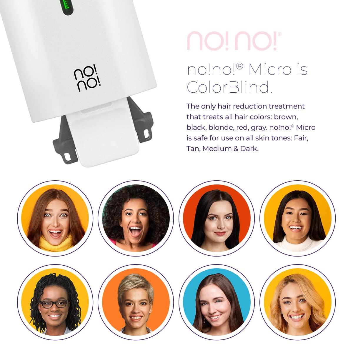 no!no! no!no! Micro Hair Removal Device - Rechargeable & Portable for All Skin Tones, Facial & Body Hair Removal for Women & Men - White