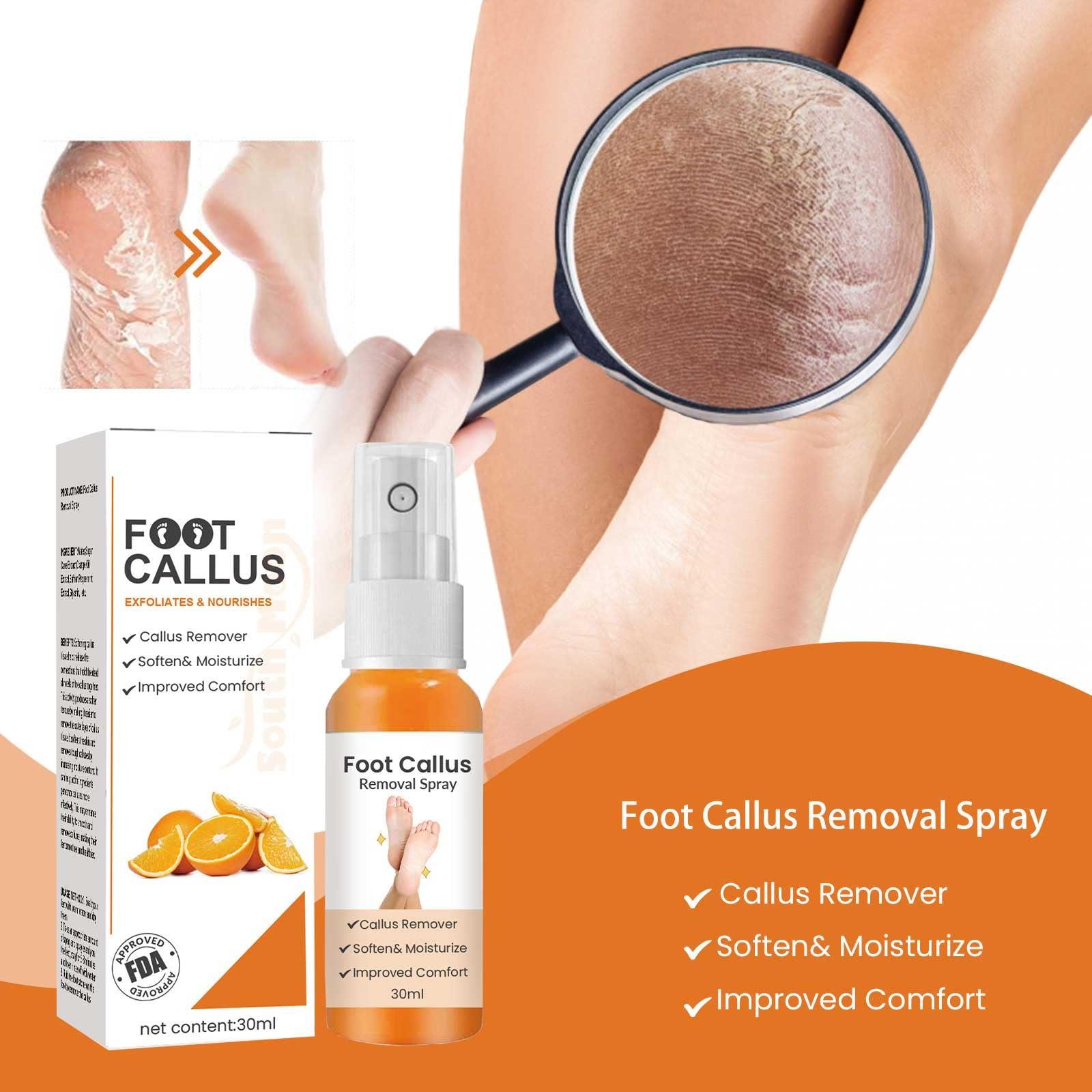 LOEBKE Foot Callus Removal Spray,Foot Heel Callus Remover Spray,Foot Peeling Spray Orange Oil,Foot Peel Spray That Remove Dead Skin,Exfoliating Peeling & Calluses On Feet (1PCS)