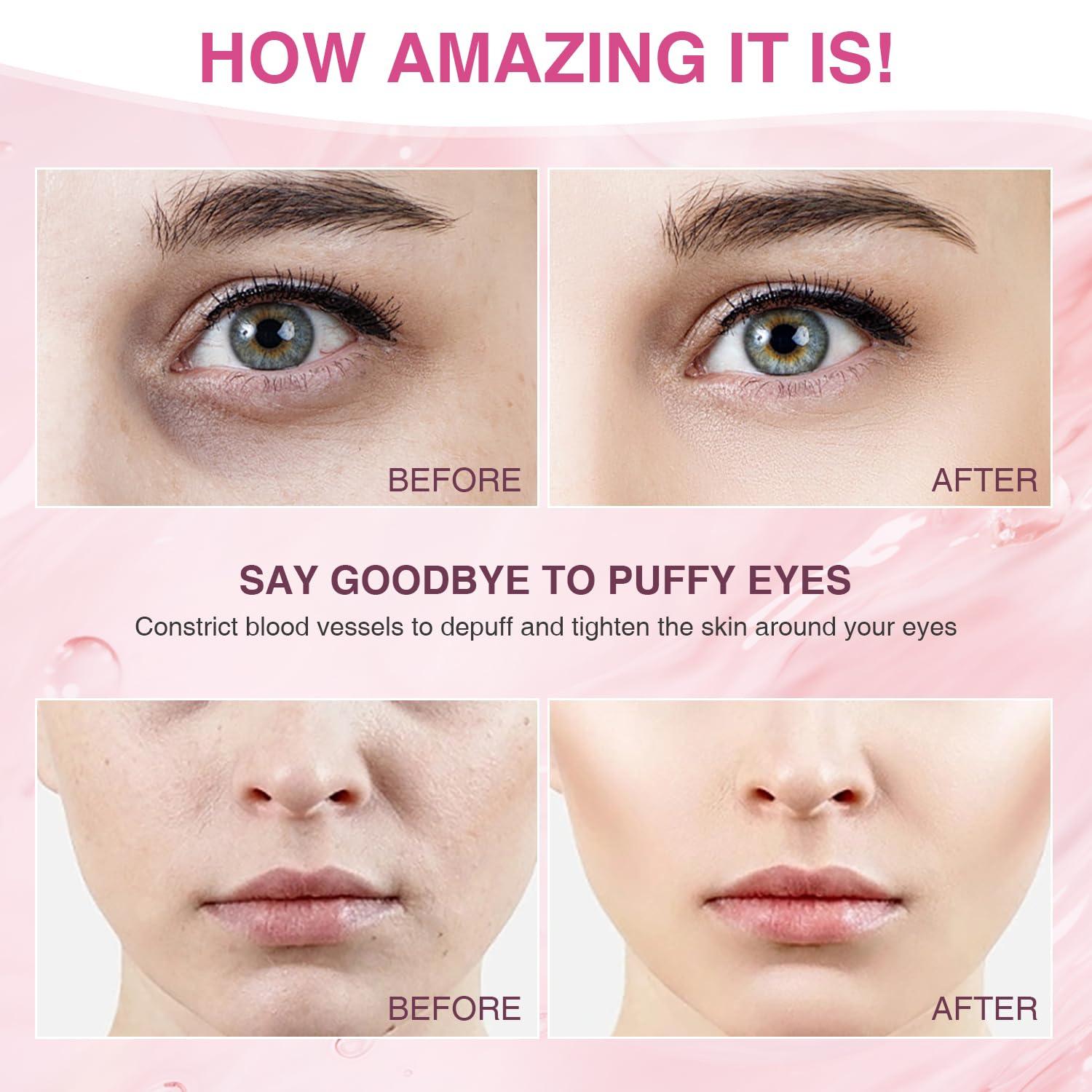 Intenso Intenso Ice Roller for Face, Ice Face Roller & Eye Puffiness Relief, Hot Mess Chilled Roller -Skin Care Reduce Wrinkles, Face Massager Roller Gifts for Women, Self Care Gifts for Man