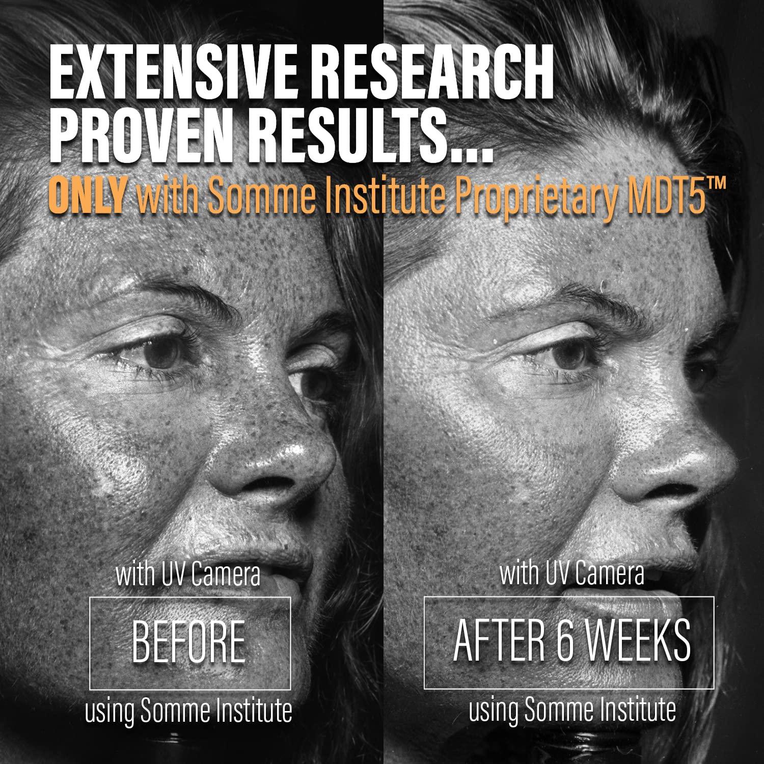 Somme Institute Daily Moisturizer with Retinol | Ultra-Lightweight Oil-Free Anti-Aging Face, Neck, Chest Moisturizer A-Bomb Hydrates, Smooths, Diminishes Hyperpigmentation | 2 Fl Oz