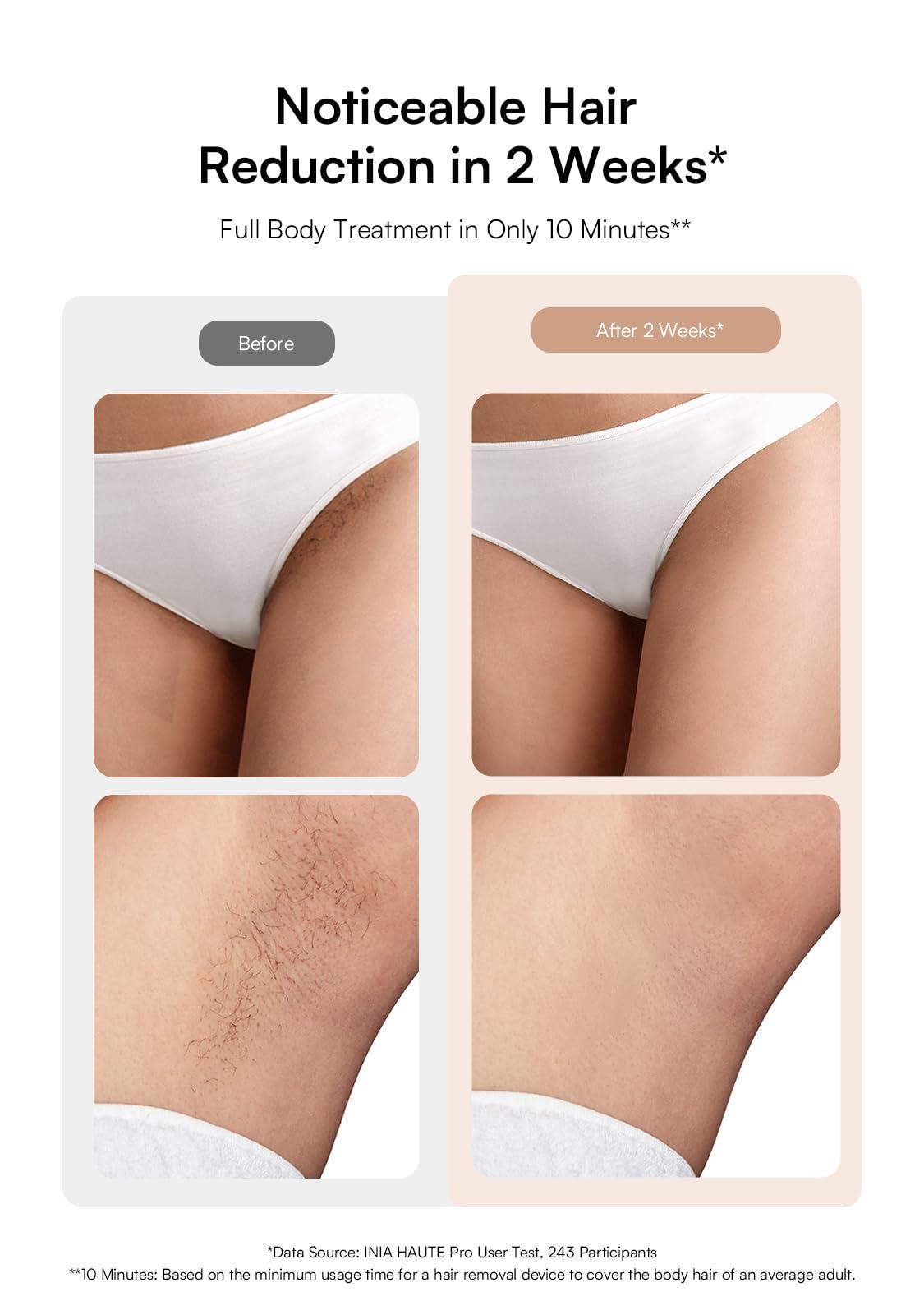 INIA INIA Laser Hair Removal with Ice-Cooling Care for Women and Men, Painless At-Home IPL Hair Remover for Coarse Hair in Bikini and All Body Areas, Latest Generation for Effective & Long-Lasting Results