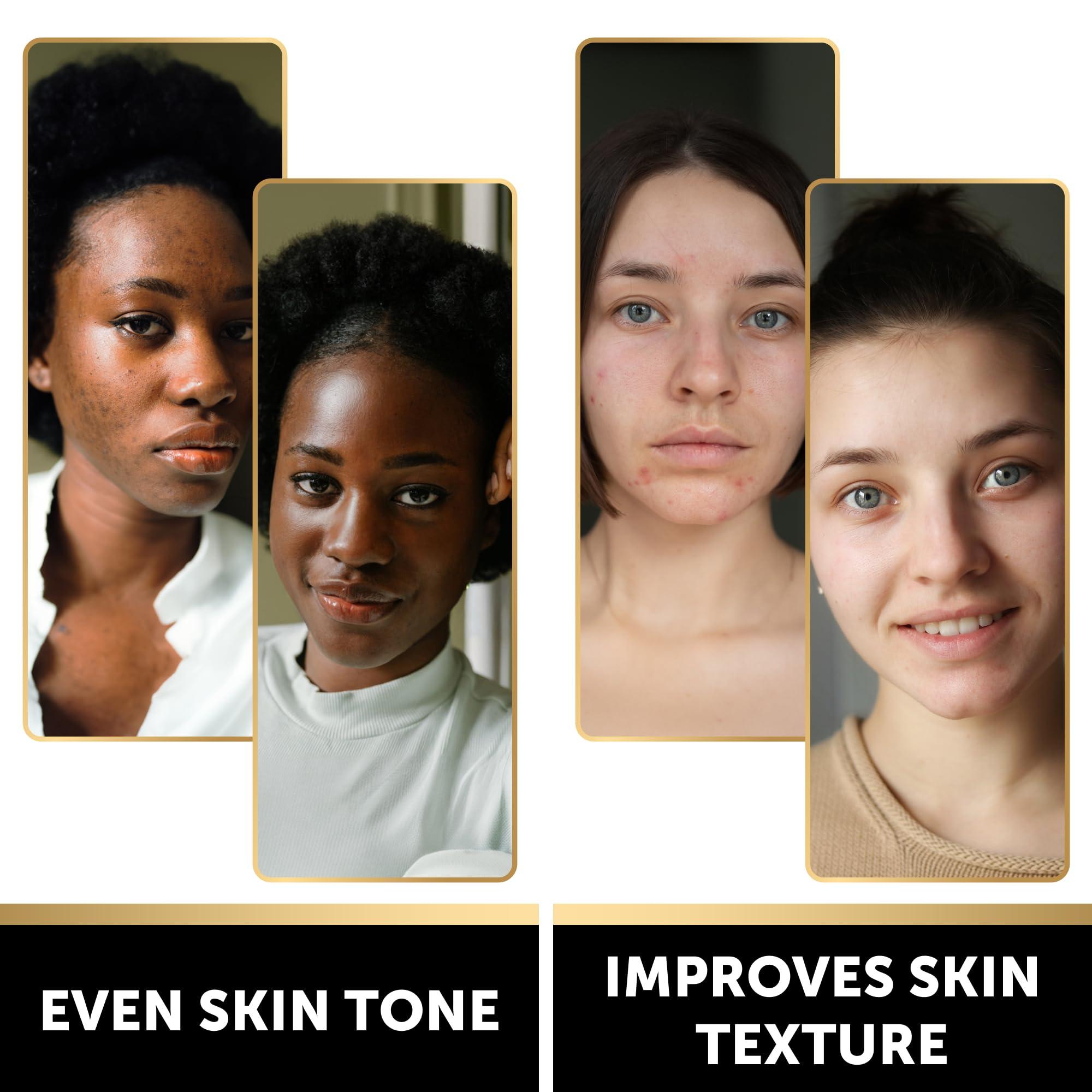 VALITIC VALITIC Charcoal Kojic Acid Turmeric Black Soap Bar Dark Spot Remover for Body or Face Wash - 4 Pack