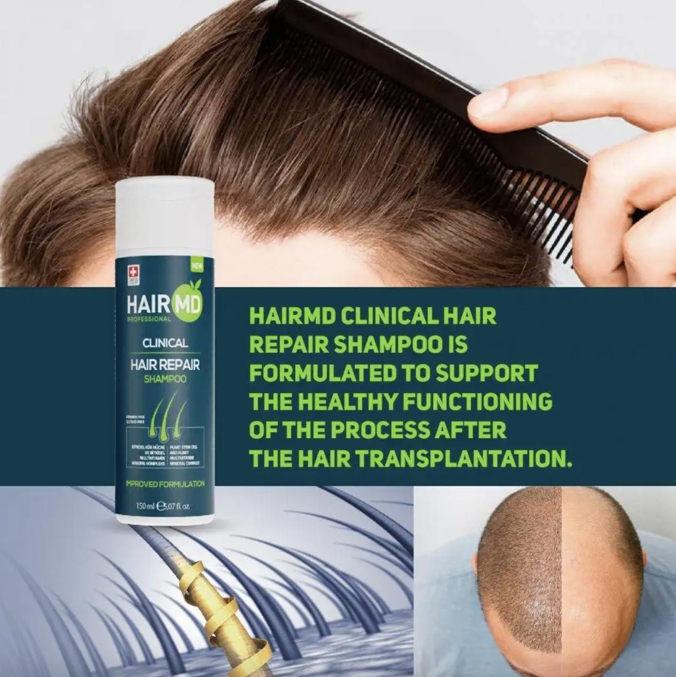 Hairmd HairMD Transplant Clinical Repair Shampoo - 150ml Biotin Shampoo for Hair Growth, Exclusive Anti Hair Loss Sensitive Shampoo