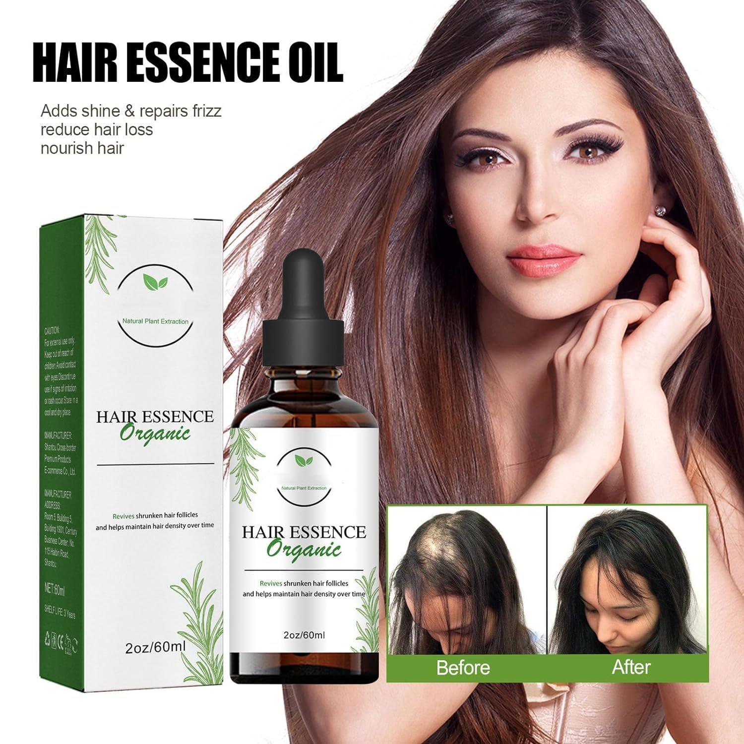 Yawlex Shelure Extreme Hair Growth and Regrowth Oil - Best Hair Oil for Luscious Locks (2pcs)