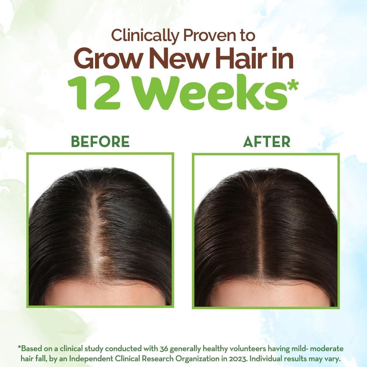 MAMAEARTH Mamaearth Rosemary Hair Growth Oil | Anti Hair Fall Tonic | Strengthening Oil with Fenugreek Seed | Gives Soft, Smooth, Shiny & Strong Hair | 6.76 Fl Oz/200 ml