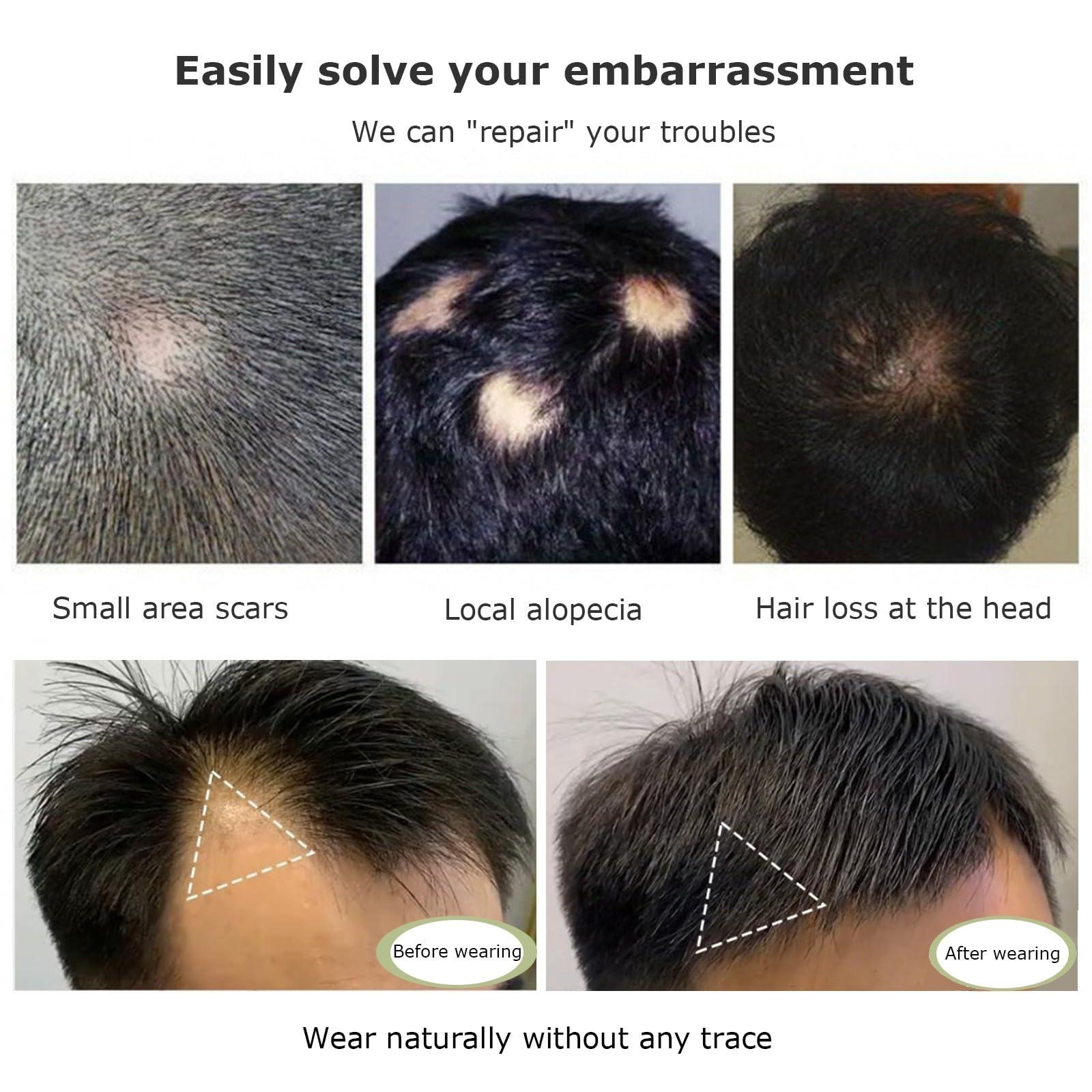 CVCNMXLXD CVCNMXLXD Bald Spot Hair Patch Toupee Scar 100% Human Hair Replacement,Human Wig Patch For Woman And Men Thinning Hair Or Hair Loss Hair System(2PCS,4x4x3)
