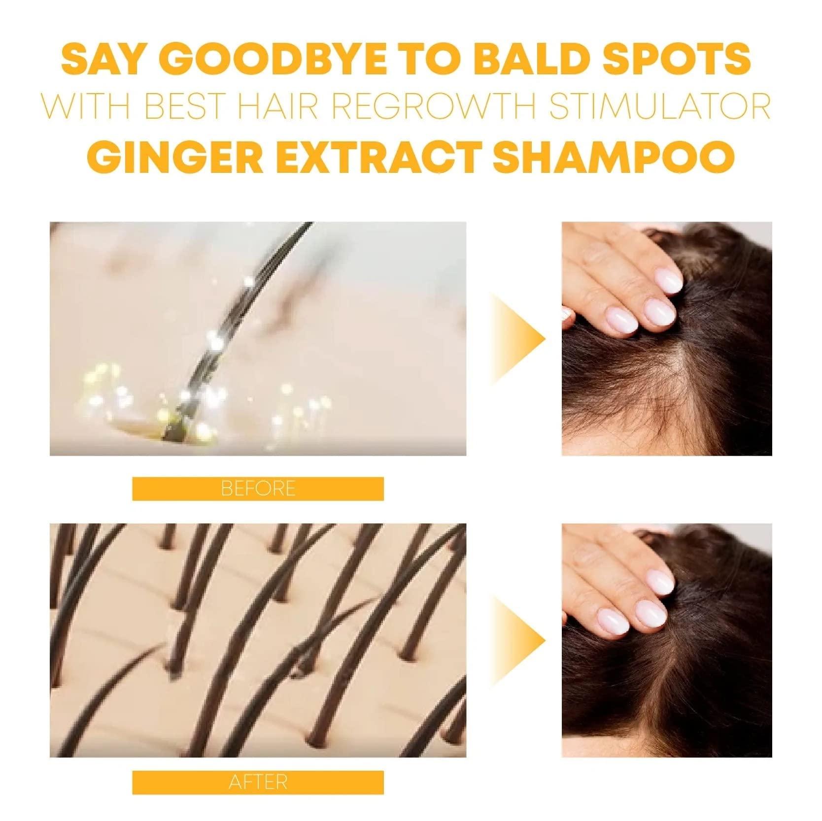 ANEFOSE puraGinger Hair Reborn Anti Thinning Shampoo, Pura Ginger Hair Reborn Anti Thinning Shampoo, puraGinger HairReborn AntiThinning Shampoo, puraGinger Shampoo, for Hair Growth Hair Care (280ml Shampool)