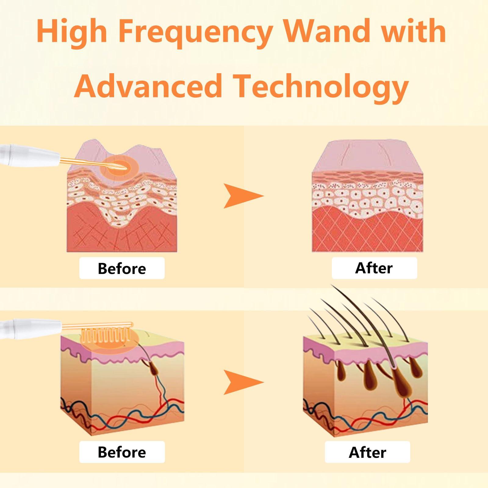 LiQiAMEi High F Rrequency Facial Wand for Face Care, Multi-Function Face Device Machine