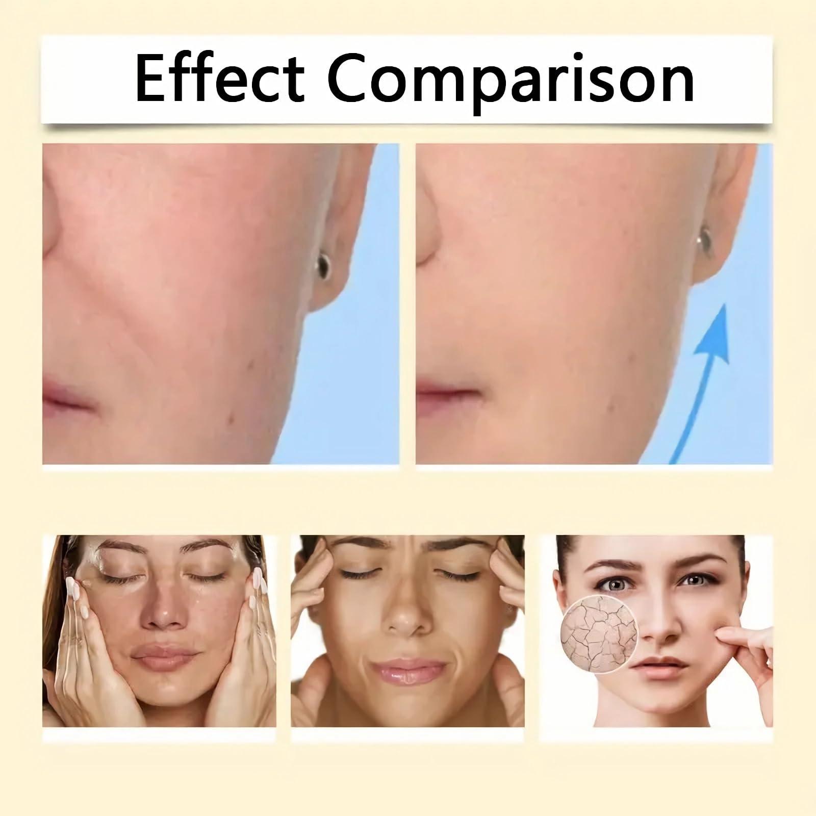 Dyshi New Botox Bee Venom Cream Anti-Wrinkle Firming Multi-Purpose Cream, Upgrade Bee Venom Wrinkle Removal Skin Treatment Cream, Bee Venom Moisturizer Cream for All Skin Types (1)