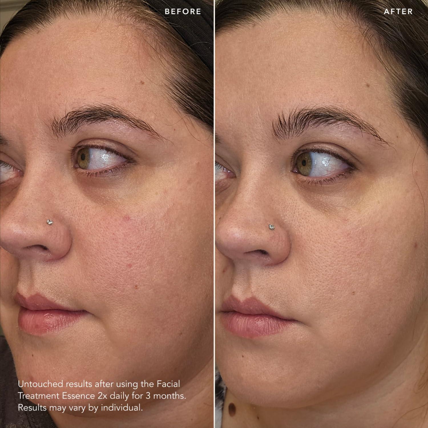 SK-II SK-II Facial Treatment Essence - Anti-Aging Essence Skincare to Help Reduce The Appearance of Fine Lines & Wrinkles - Visibly Refines Texture & Improves Firmness & Dark Spots (7.7 oz)