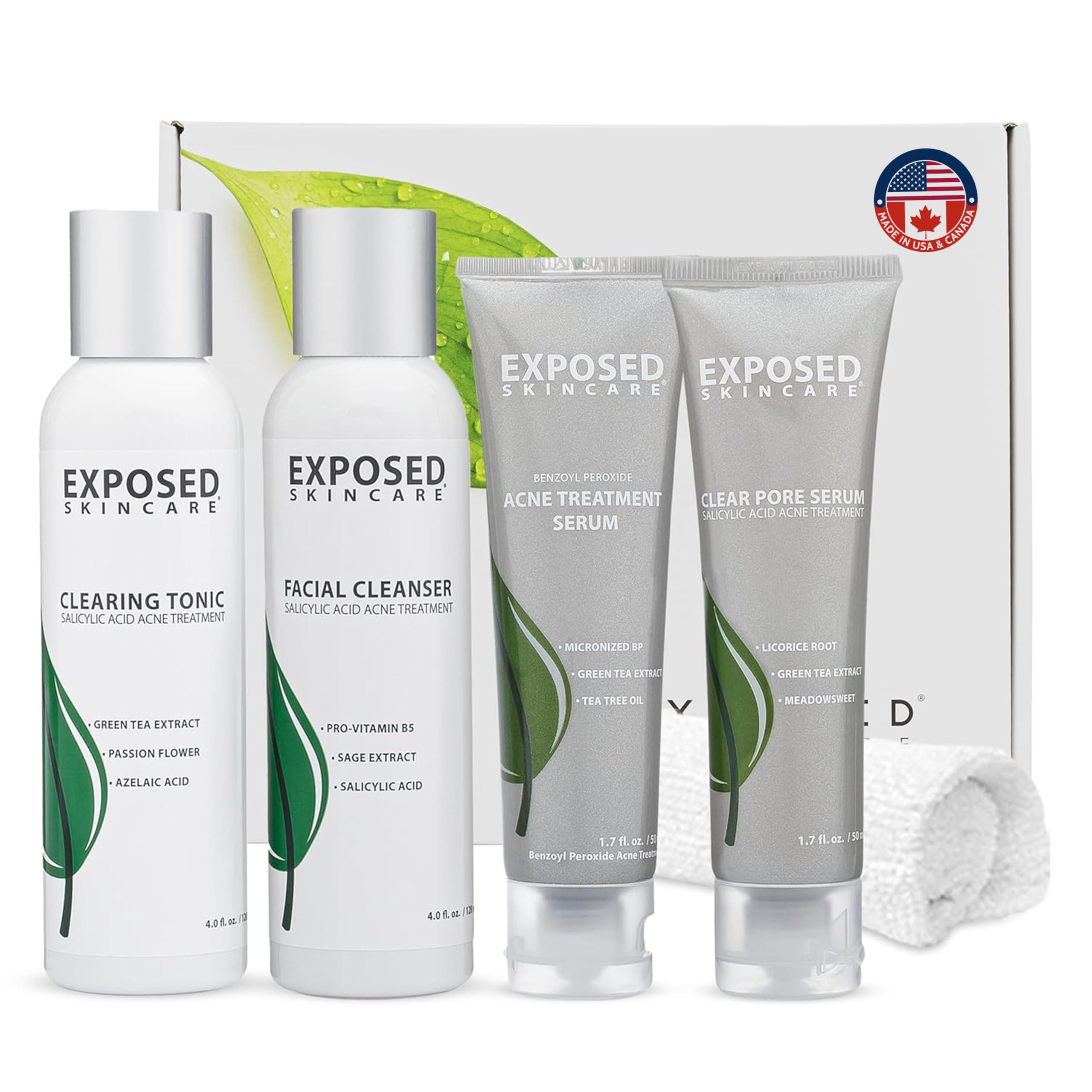 Exposed Skin Care Exposed Skin Care Basic Acne Treatment Kit - Includes Salicylic Acid Face Wash, Clearing Tonic, Acne Treatment Serum with Benzoyl Peroxide, Clear Pore Serum - Acne Set Solution for All Skin Types