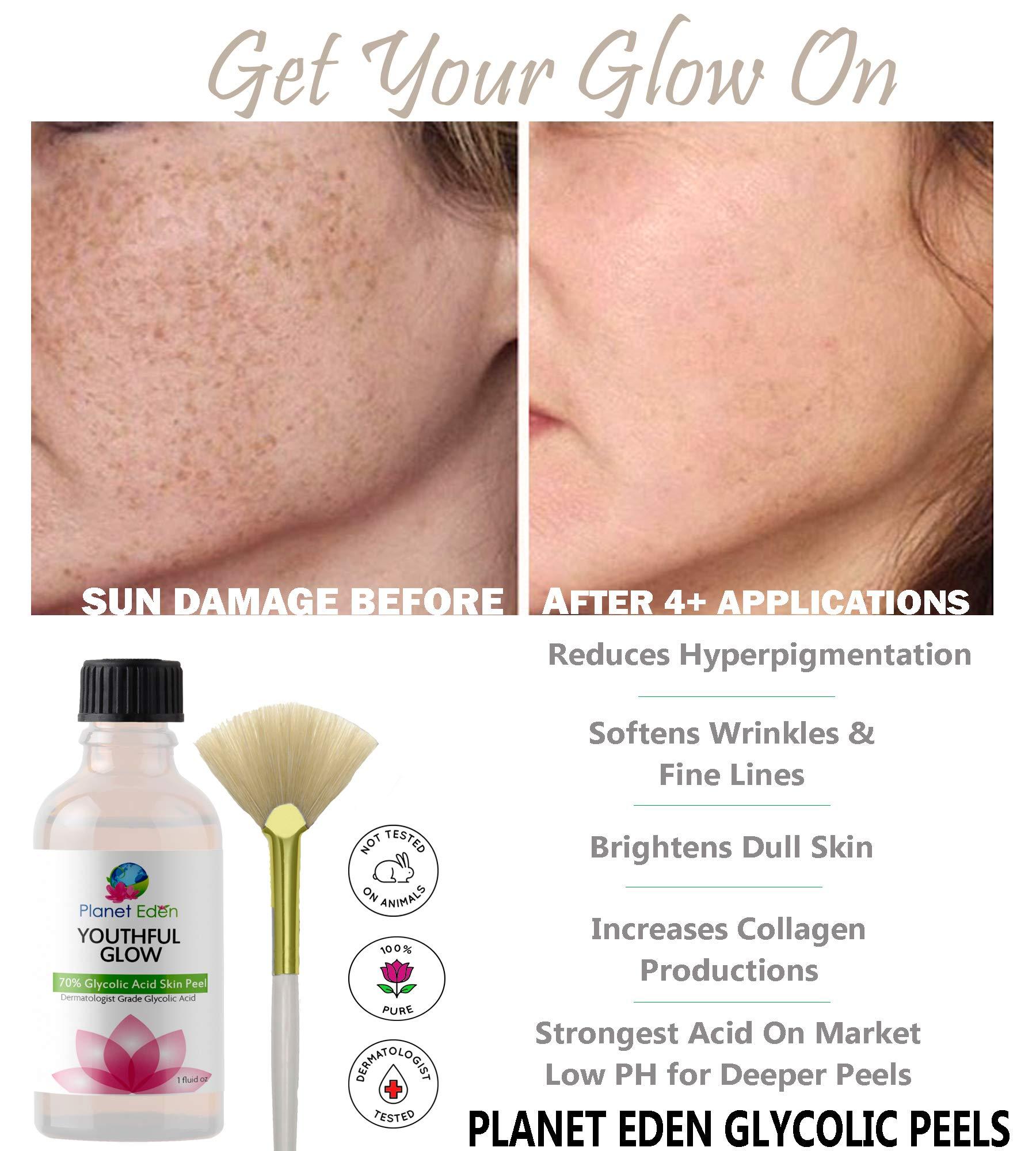 Planet Eden Planet Eden 30% Glycolic AHA Acid Skin Chemical Peel Kit with Fan Brush for Diminishing Sun Damage, Dark Spots, Fine Lines, Wrinkles - Anti Aging AHA Peel