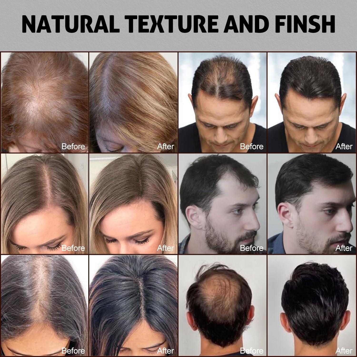 Ustar Ustar Hair Building Fibers for Thinning Hair 27.5g Light Brown Conceals Hair Loss Instantly Thicker Fuller Look 9 Shades for Women & Men