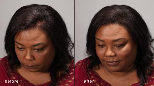 MAXX PRO-SERIES MAXX PRO-SERIES Volumizing Hair Fibers with real Keratin for Thinning Hair/Hair Loss – Dermatologist Tested and Certified Hypoallergenic - 60 days + supply - Multiple Colors Available (Dark Brown)