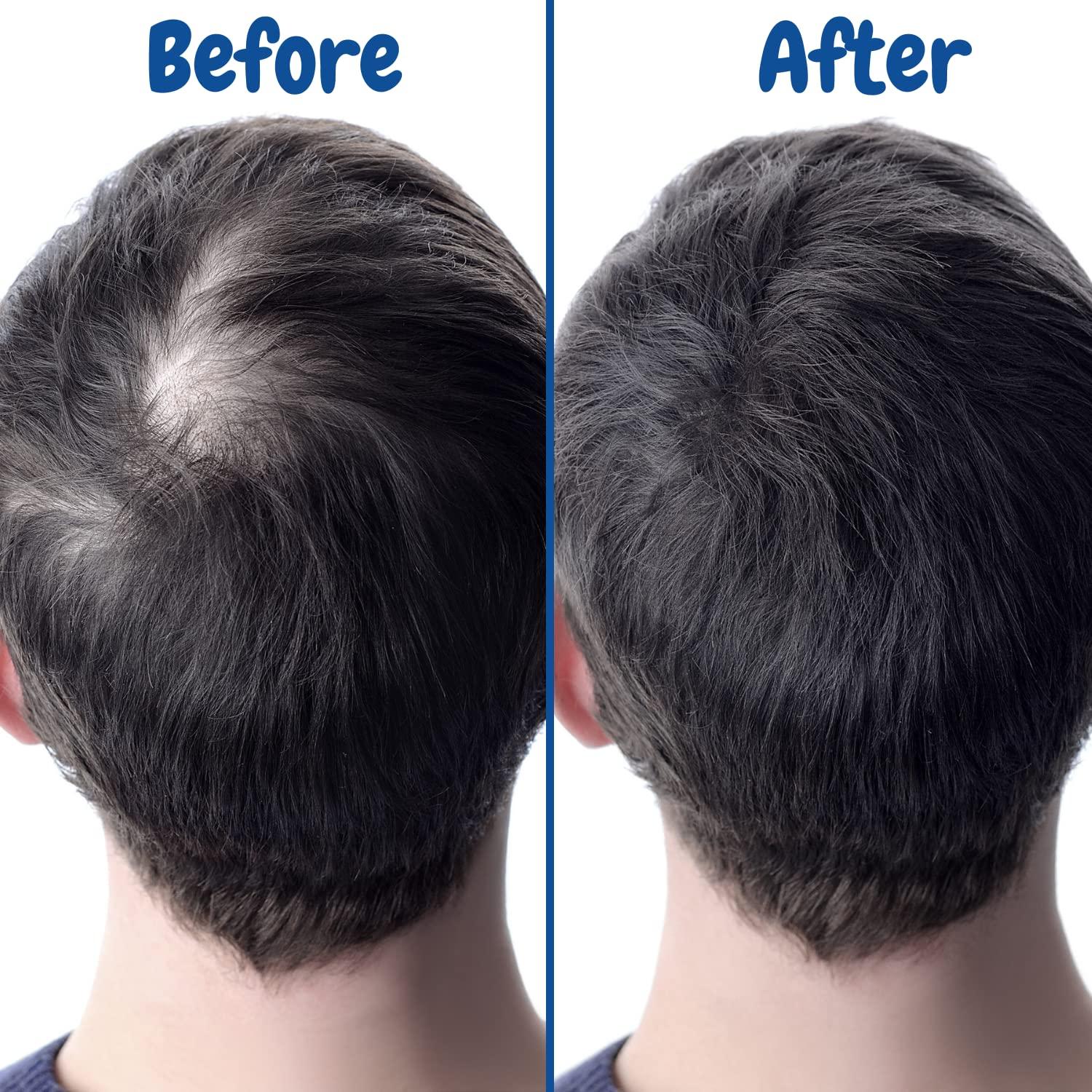 Verseo Verseo Sup Hair Growth Conditioner Treatment | Conditioner for Thinning Hair and Hair Loss | Repairing Damaged Hair | 28 Day Supply