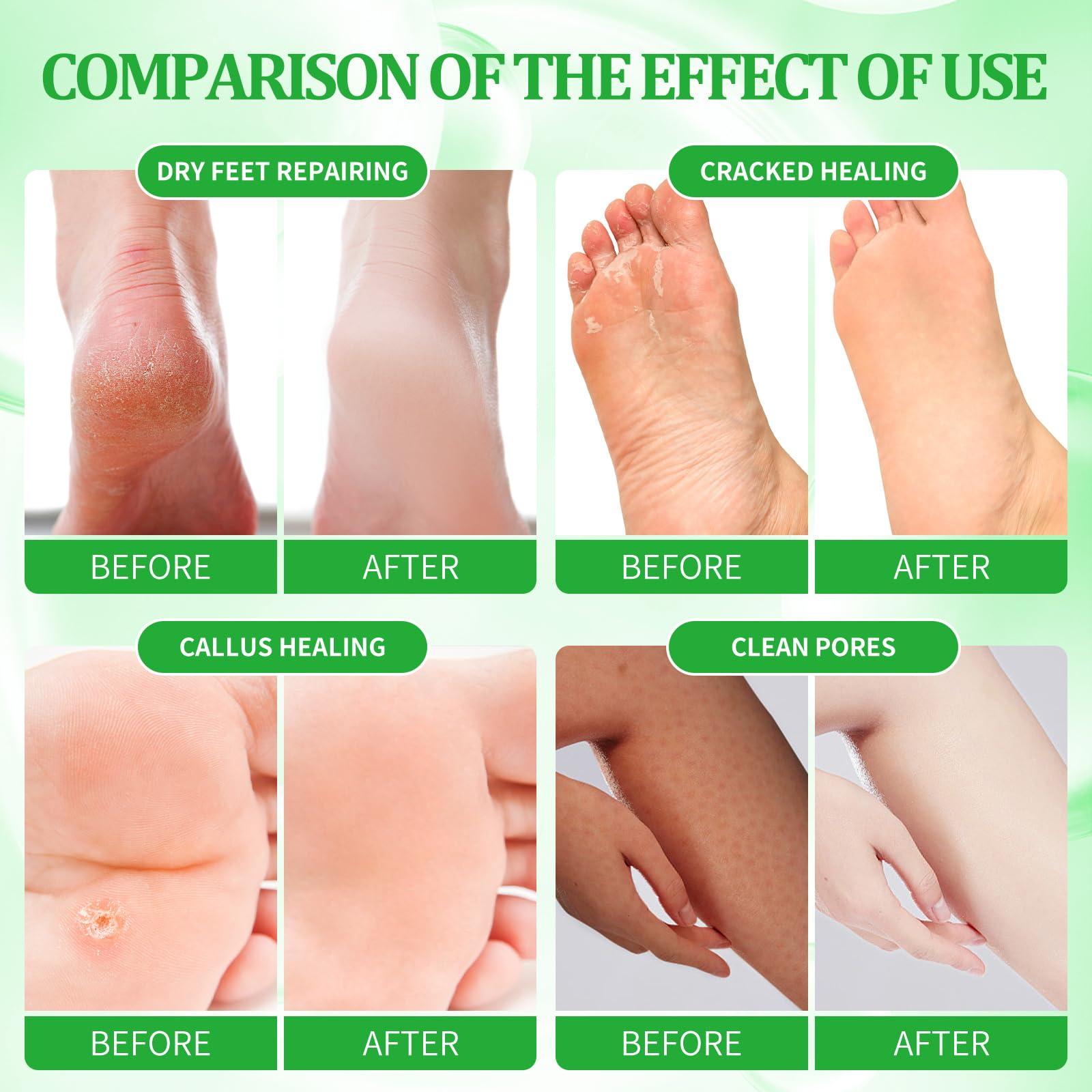 Provon Provon FMX-12 Foam Soap Dispenser, Dove Gray 6 per Carton