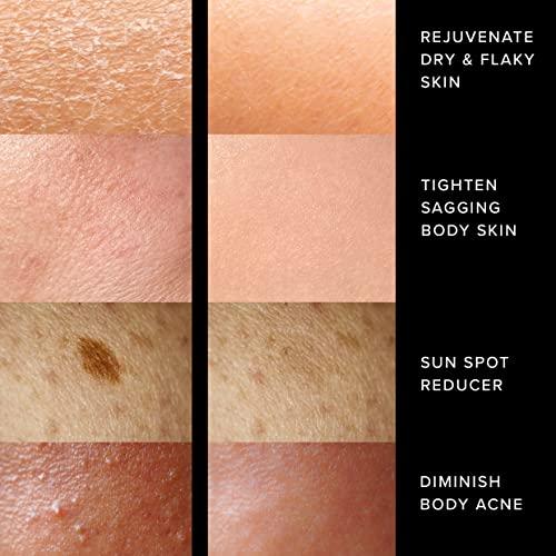 Adonia Organics Adonia StemuTone - Firm, Lift & Tighten Body – Reduce stretch marks, scars, dryness & sagging skin – Reduce the appearance of age spots – Leaves skin feeling SUPER SOFT