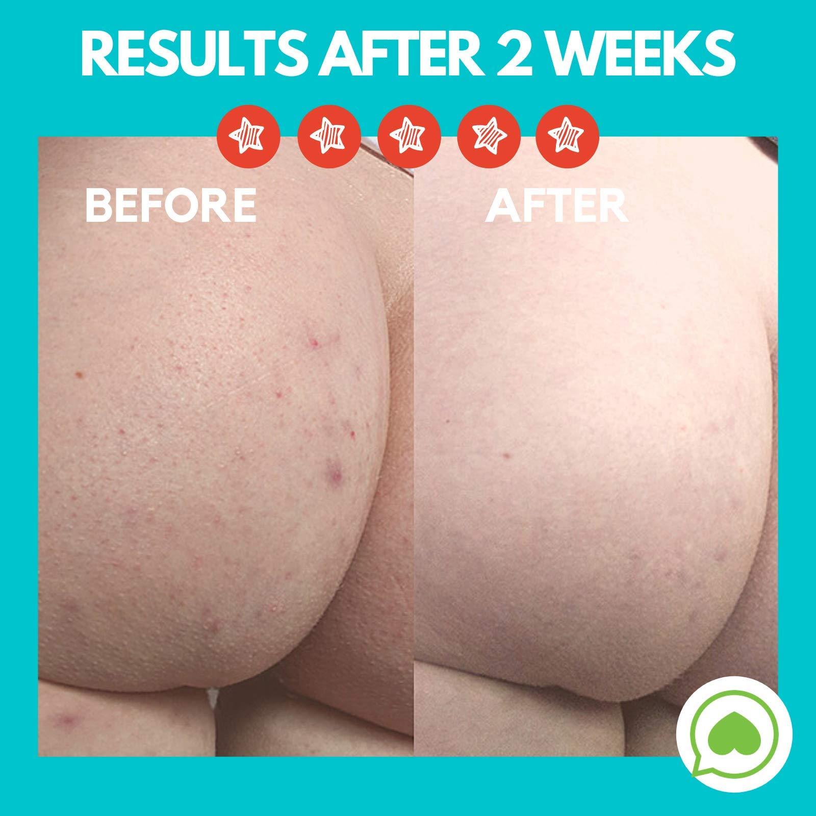 St. Ives St Ives Renewing Collagen and Elastin Facial Moisturizer, 10 Ounces (Pack of 12)