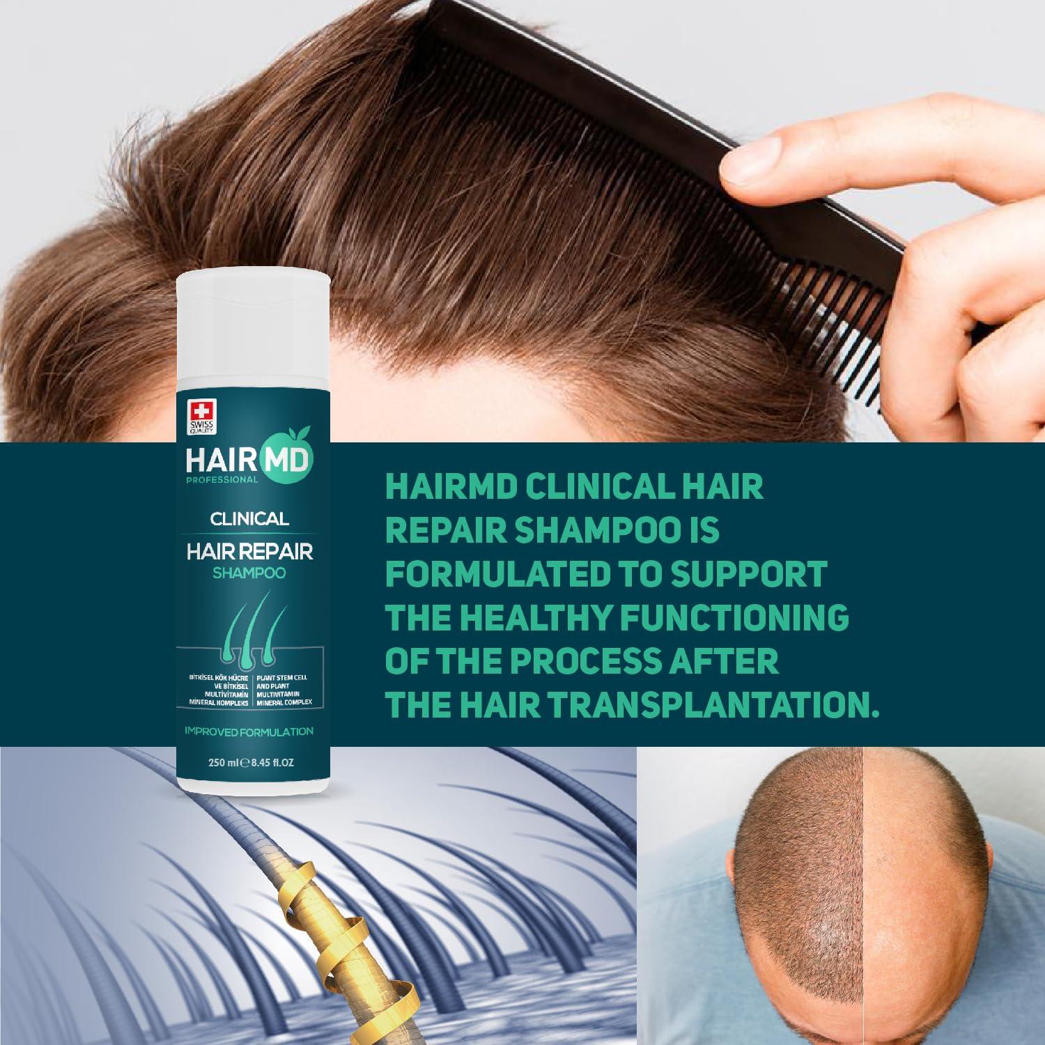 HairMD HairMD Transplant Clinical Repair Shampoo - Big Size 750ml - Advanced Regrowth Formula - Protects Post-Transplant Scalp, Exclusive Anti Hair Loss Shampoo. 25.36 fl OZ.