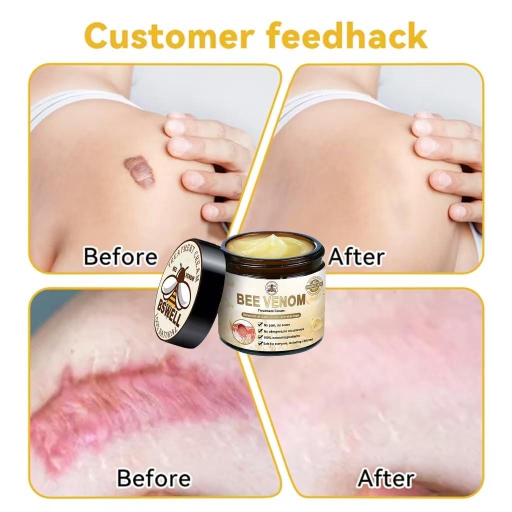 flysmus Bee Venom Skin Treatment Cream, Bee Venom Cream - 50ml, Bee venom Therapy Cream for All Skin Types (2PCS)